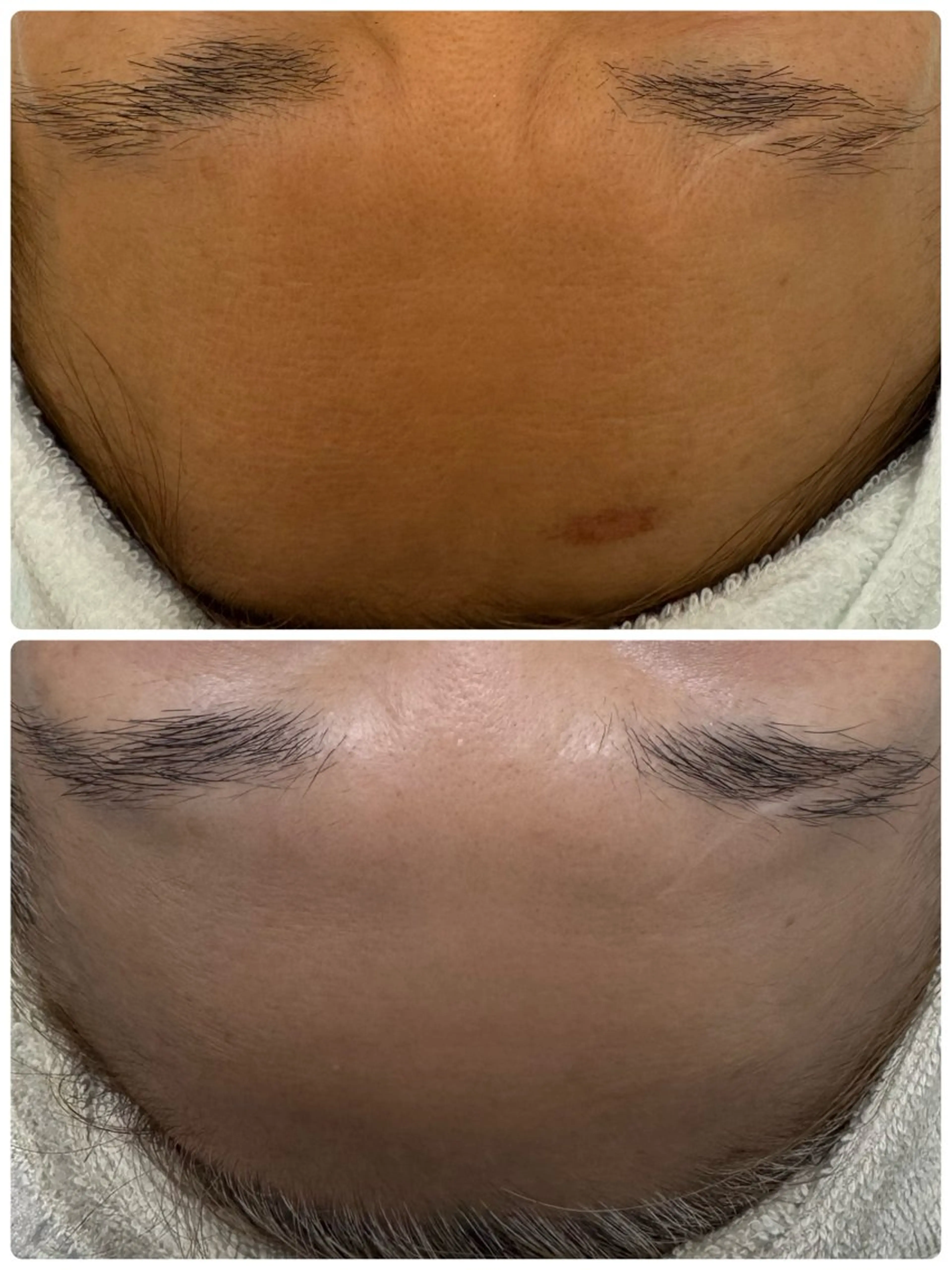 シミ毛穴専門店 yucca(ユッカ)のエステ・リラクイメージ