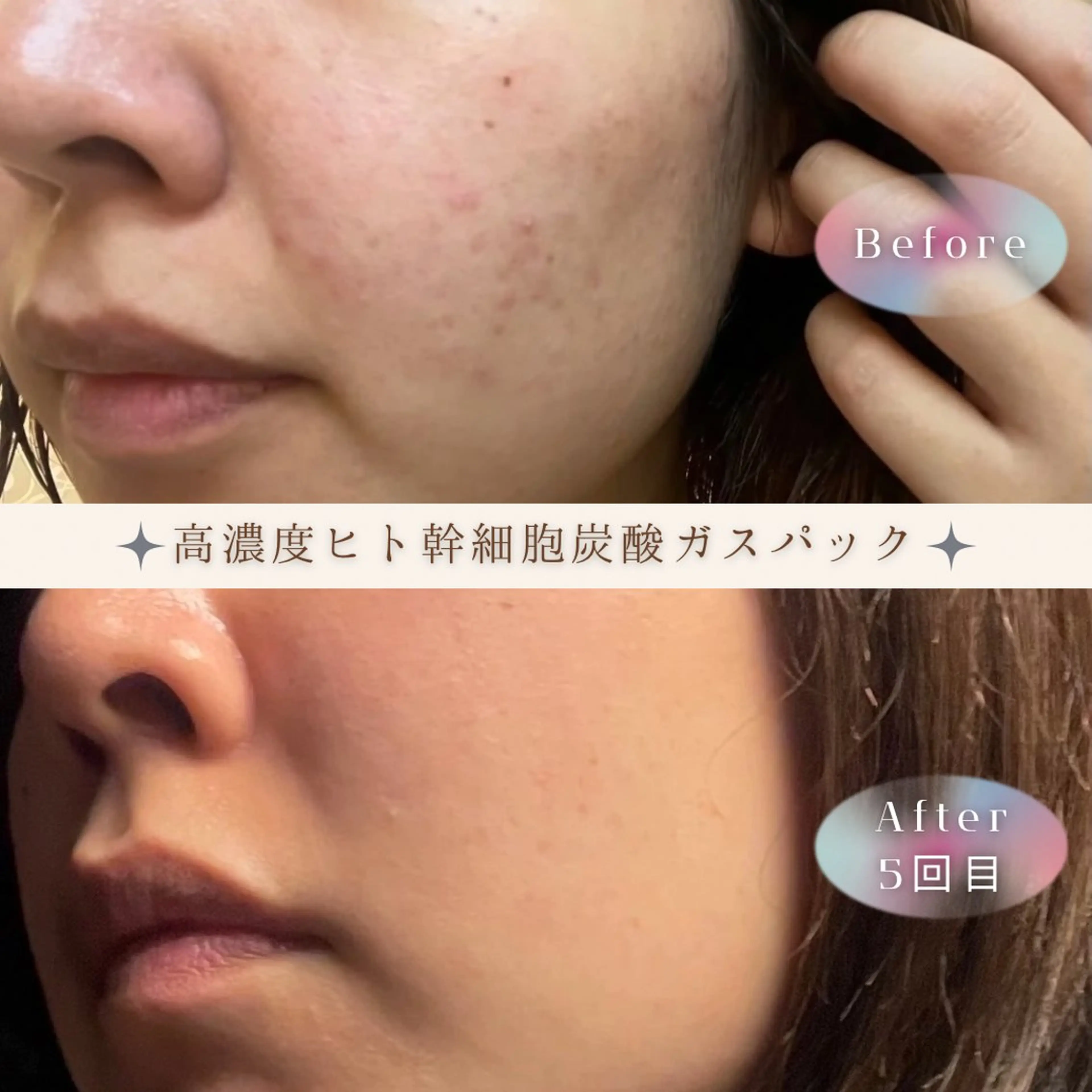 NONOKEKE ノノケケのエステ・リラクイメージ