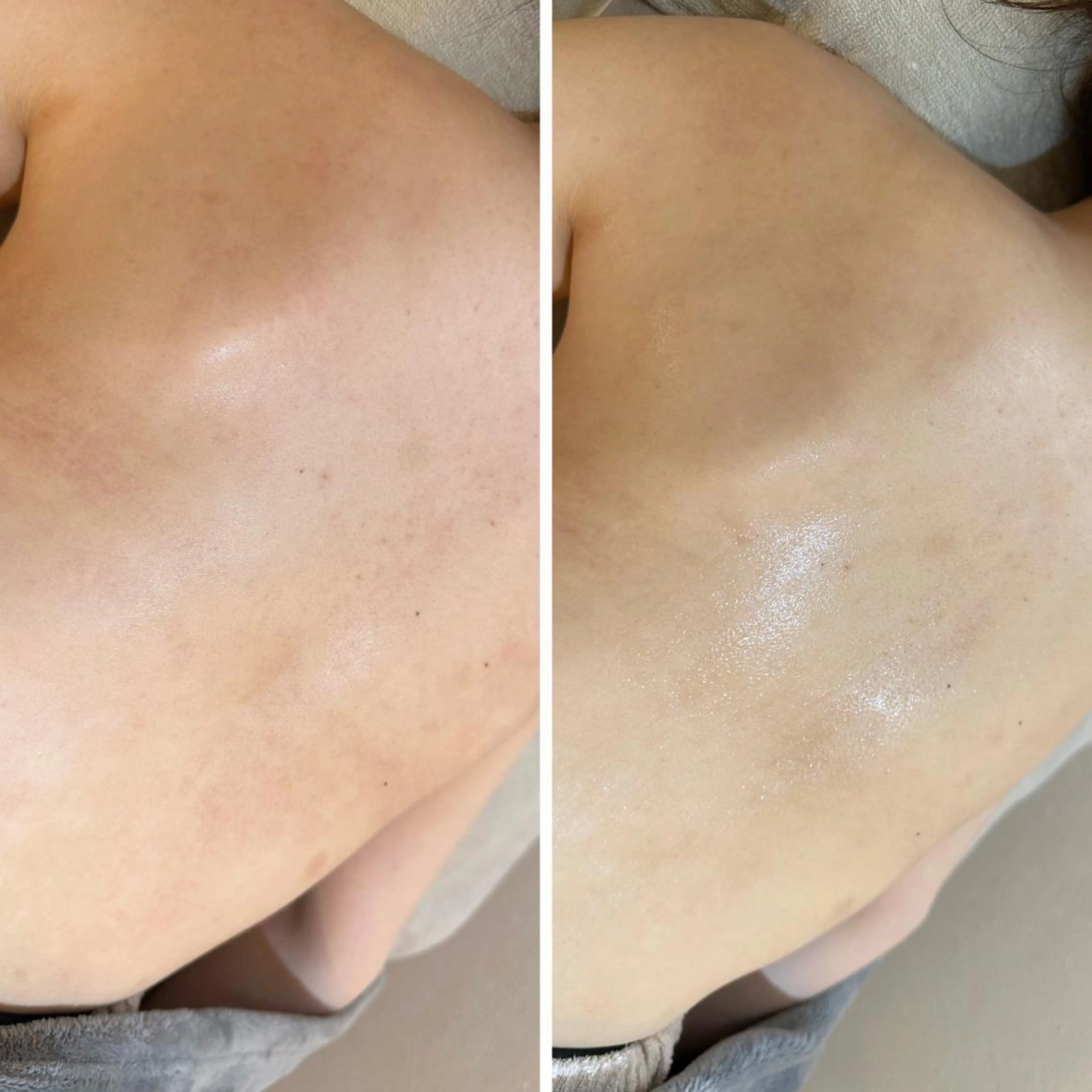 うなじ脱毛/美肌脱毛 LABELのエステ・リラクイメージ