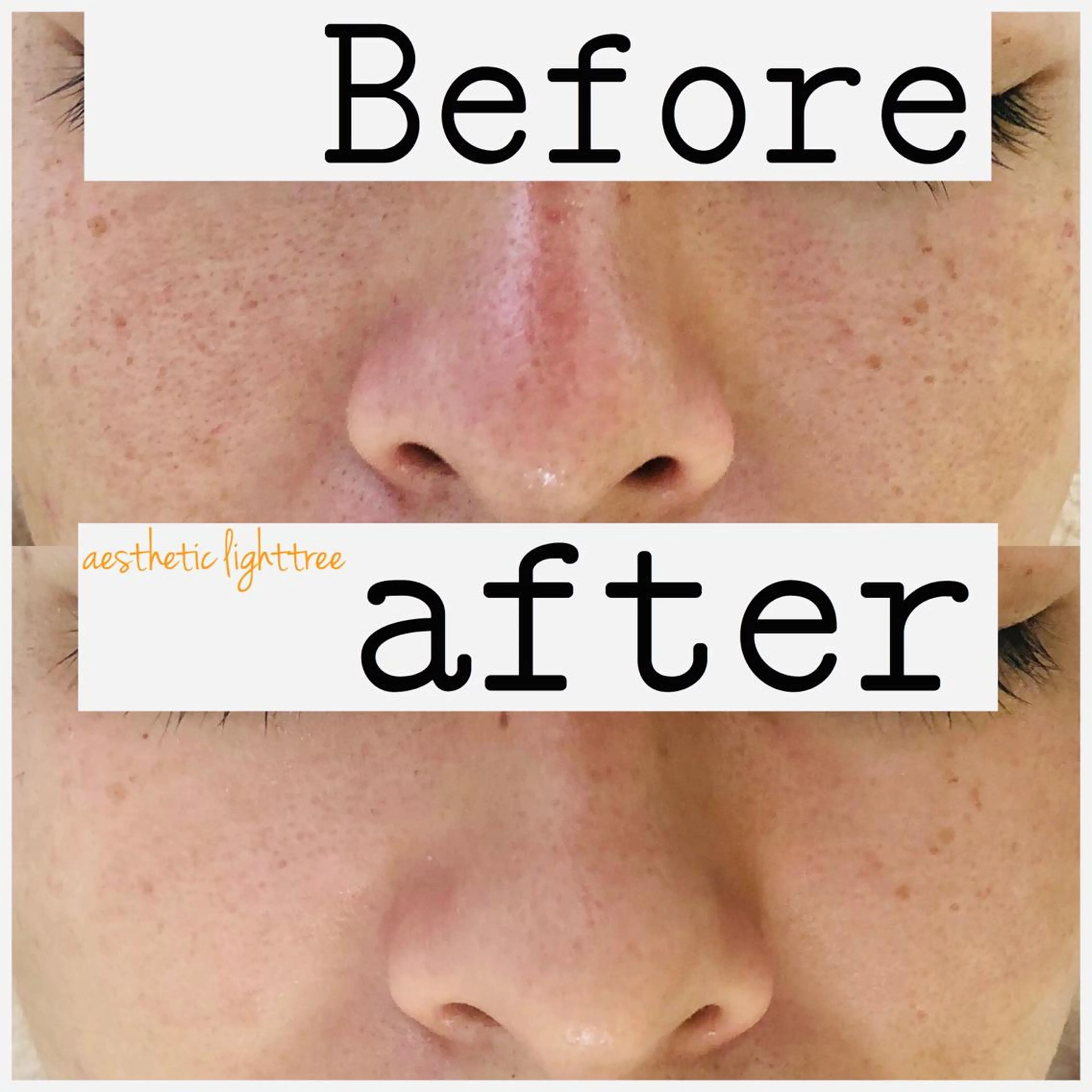 ショート カラー パーマ ヘアアレンジ メンズ キッズ ネイル マツエク・マツパ メンズネイル エステ ニキビ&跡改善サロン オーナー光木のエステ・リラクイメージ