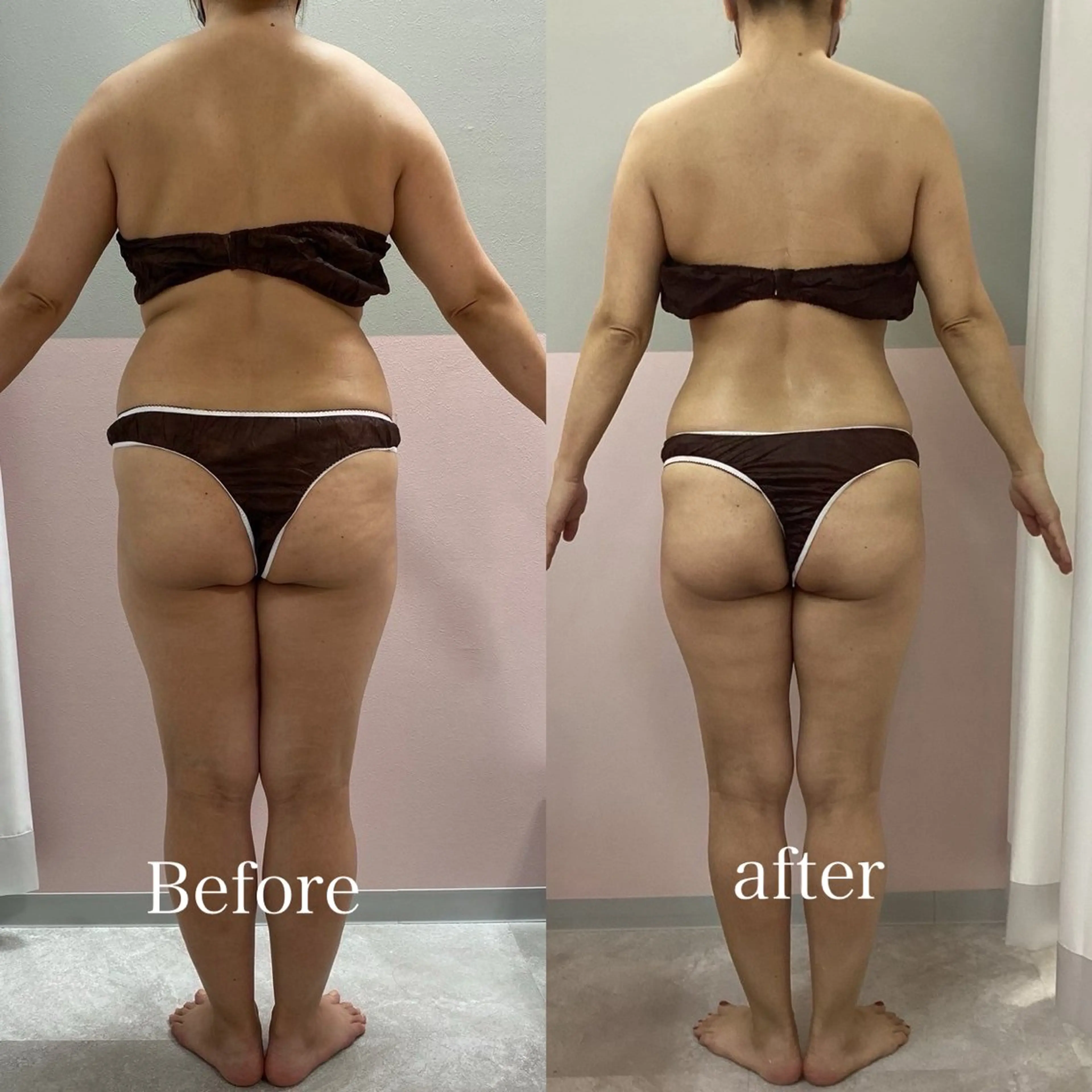 エステ nico sideのエステ・リラクイメージ