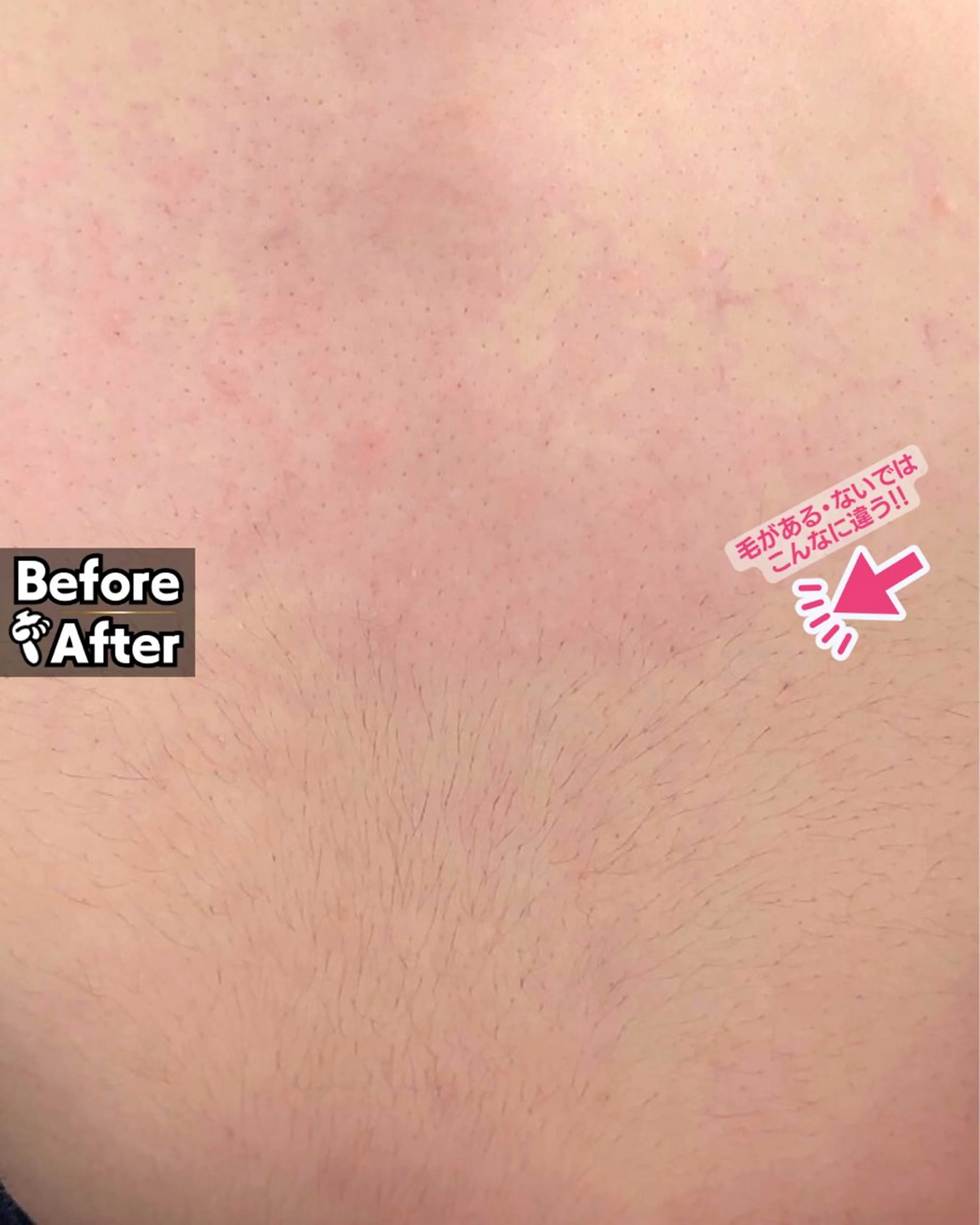 Hitomi シュガーリング豊橋のその他イメージ