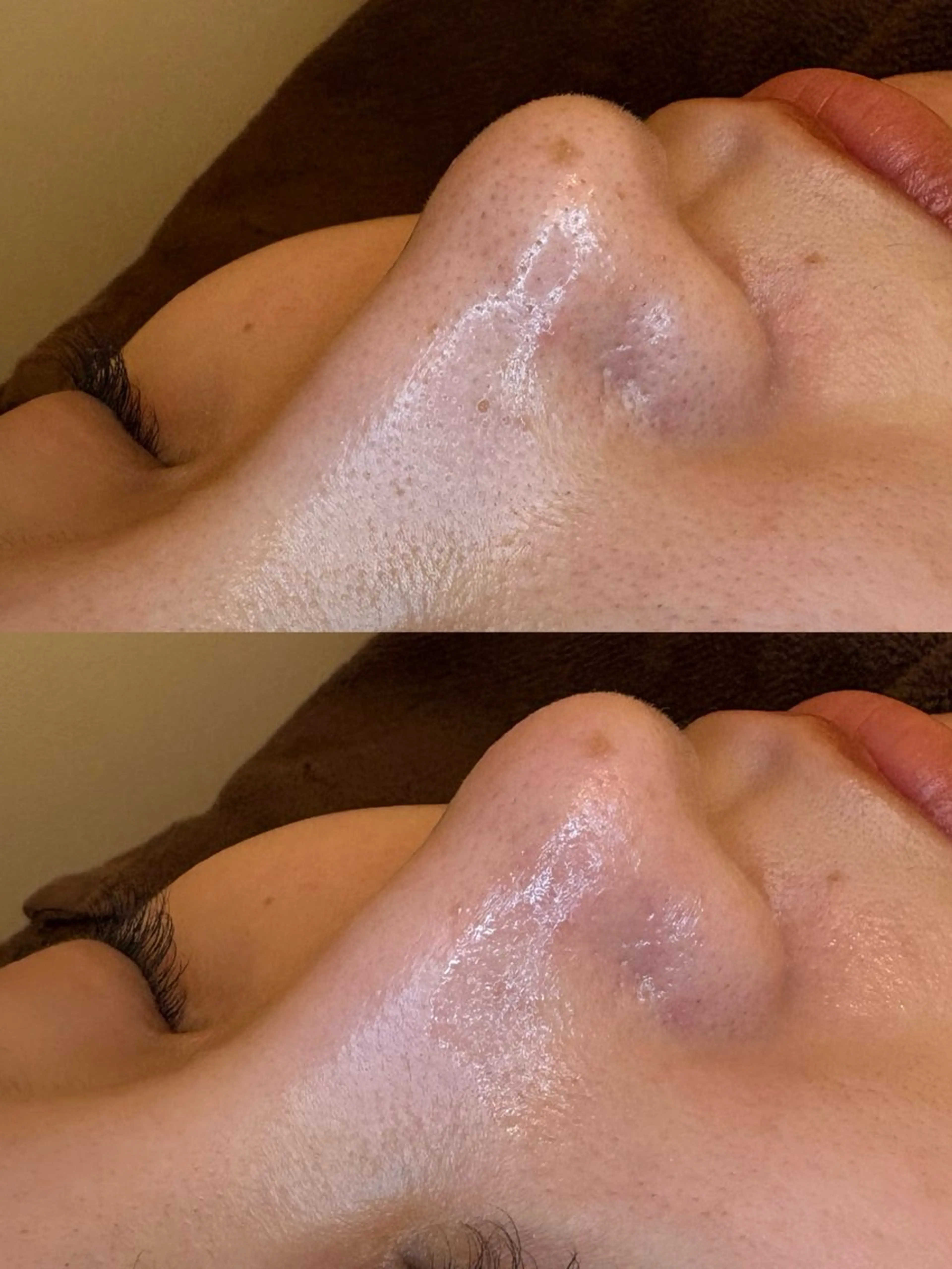 🤍アベシュリ /フェイシャル🤍のエステ・リラクイメージ