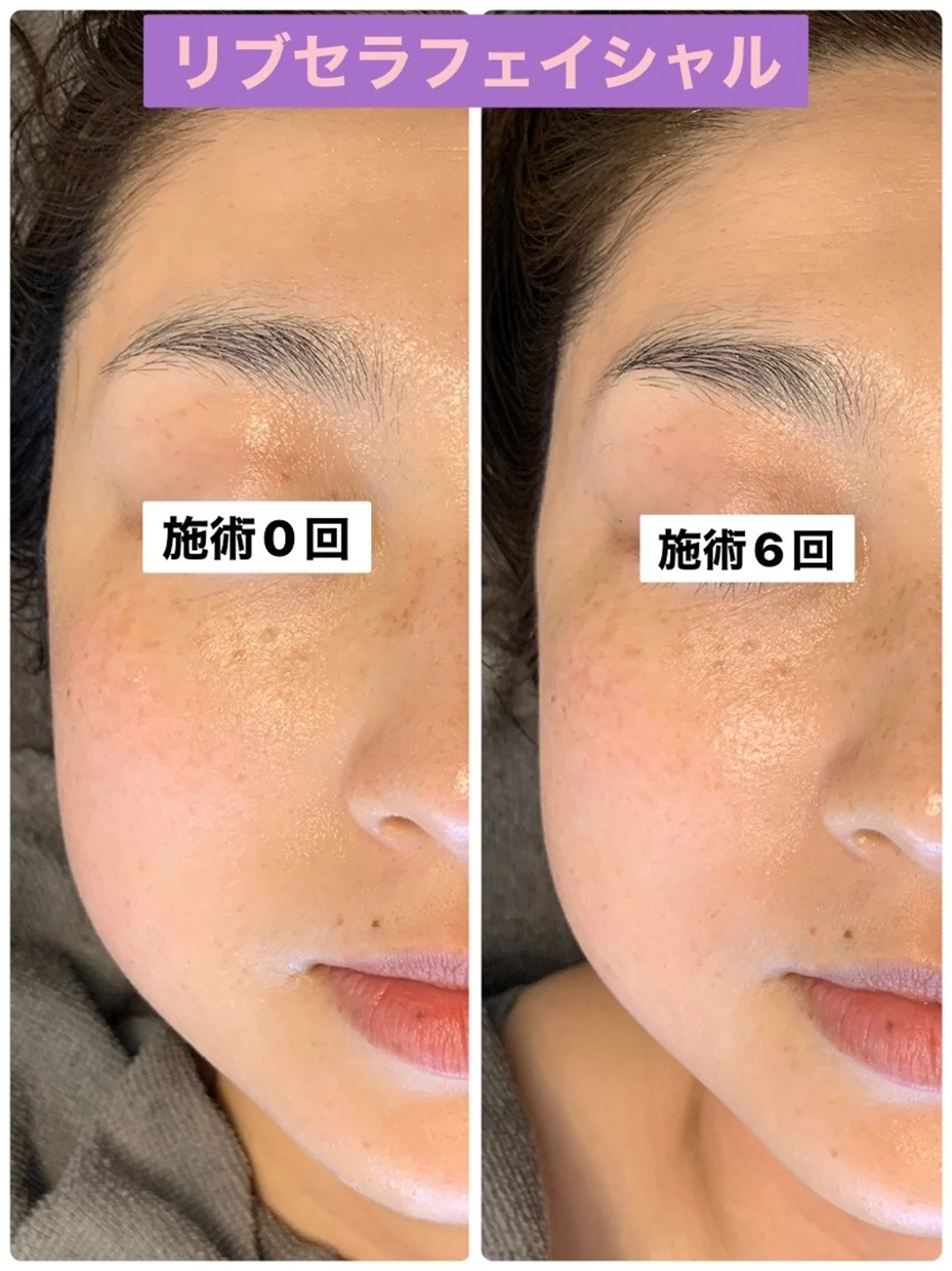 エステ プライベートサロン プリュネルのエステ・リラクイメージ