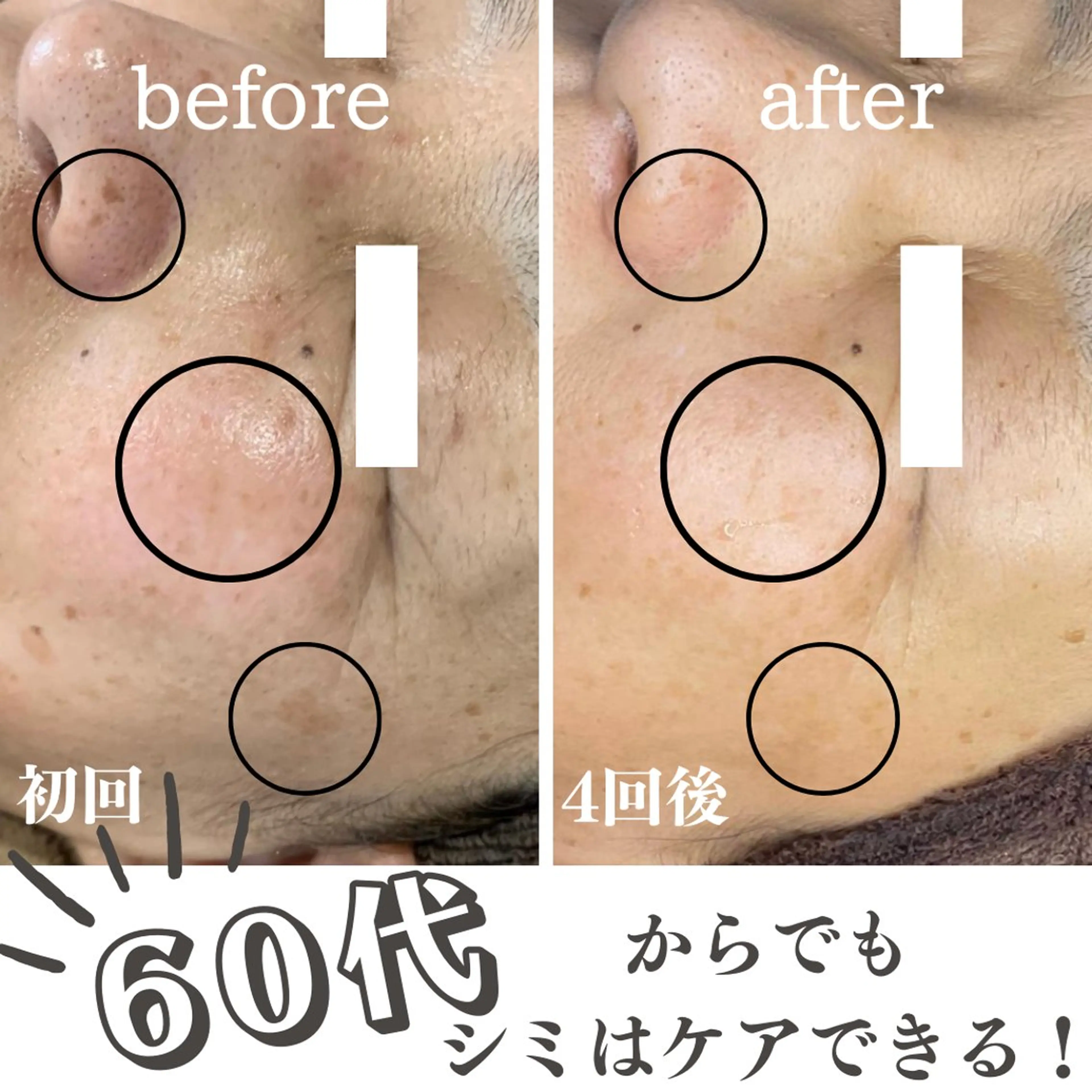 エステ 最新シミケアLily de pearlのエステ・リラクイメージ