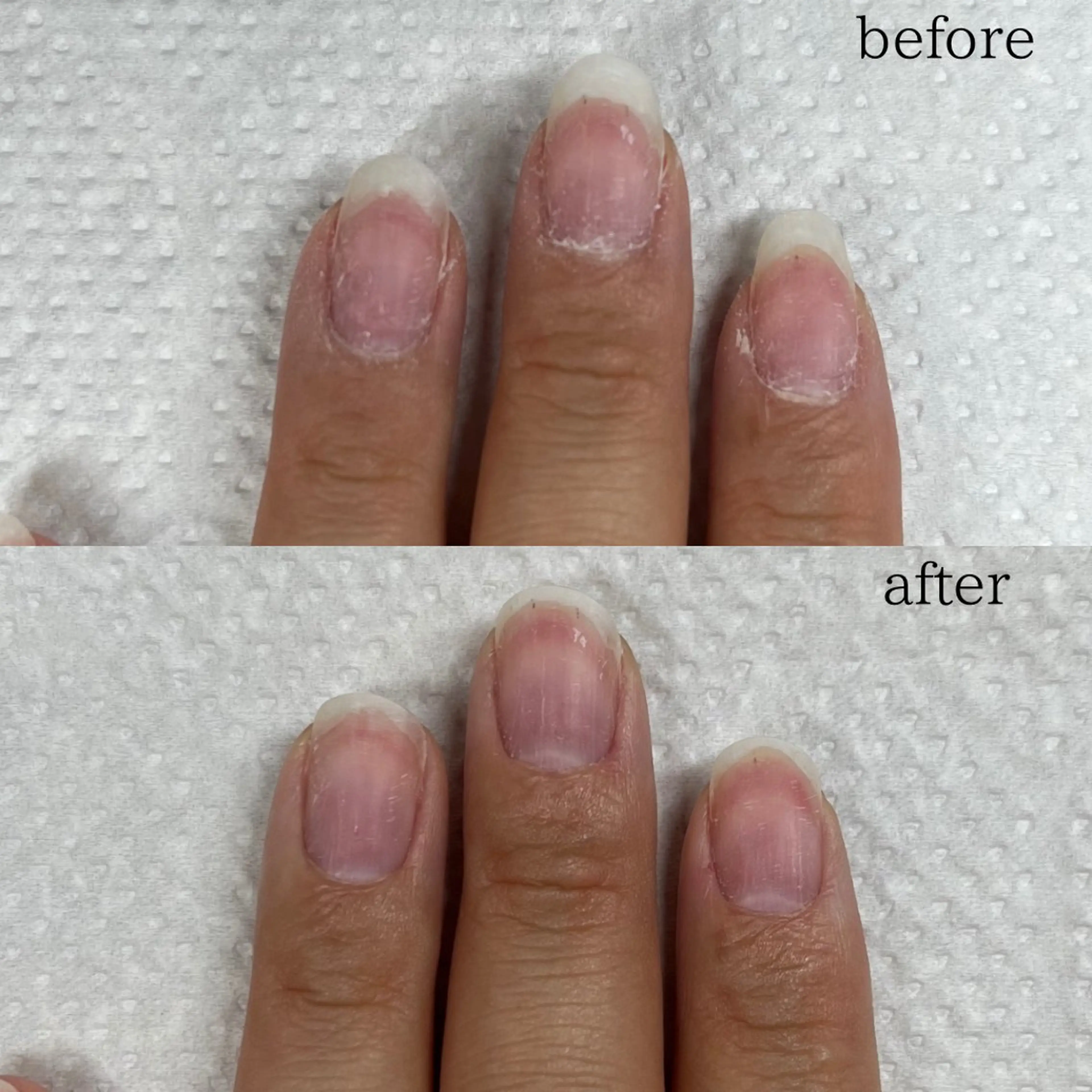 自爪育成メニュー【ケアのみ】の写真