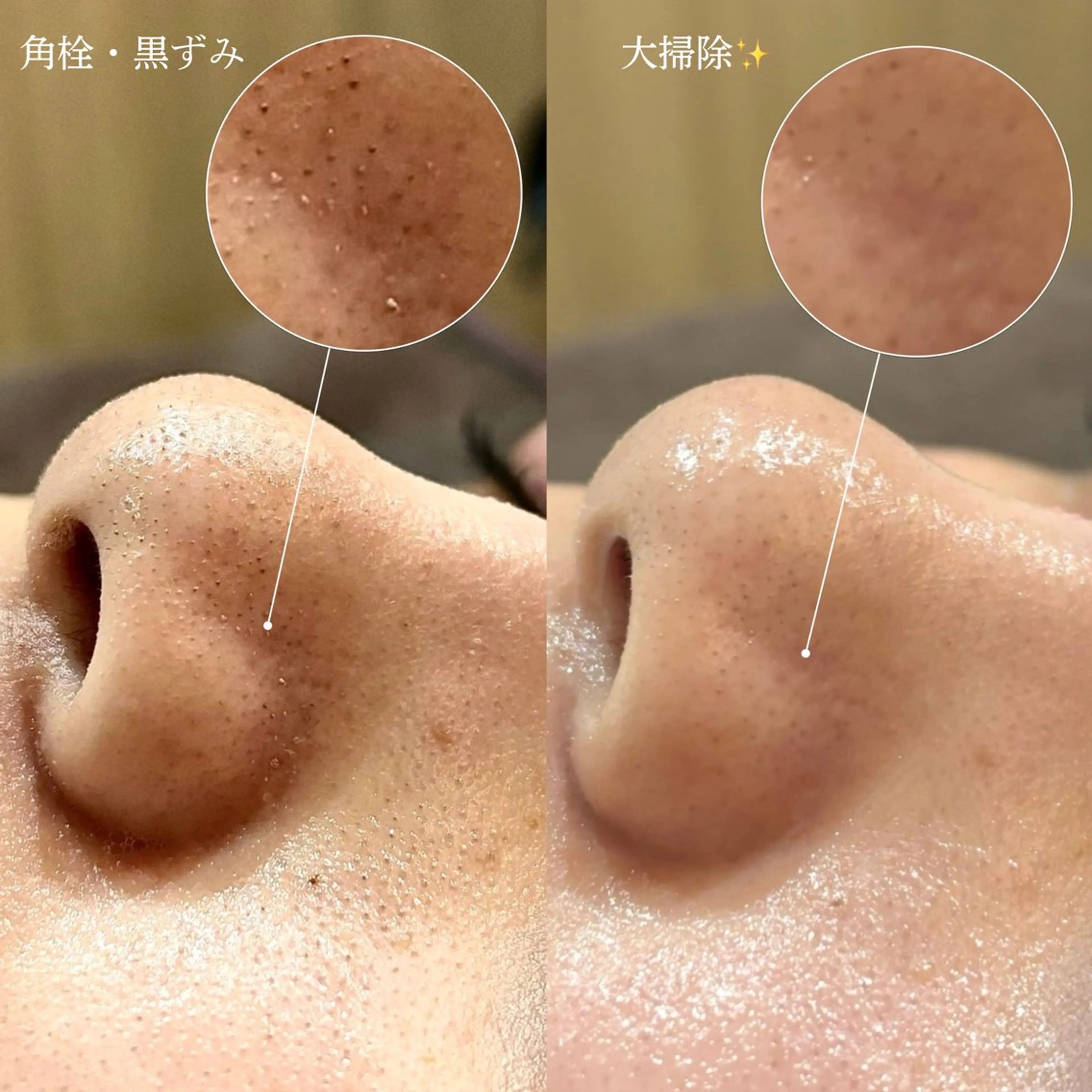 メンズ メンズ韓国風 エステ Suu.今池/千種 眉毛サロンの眉毛・アイブロウイメージ