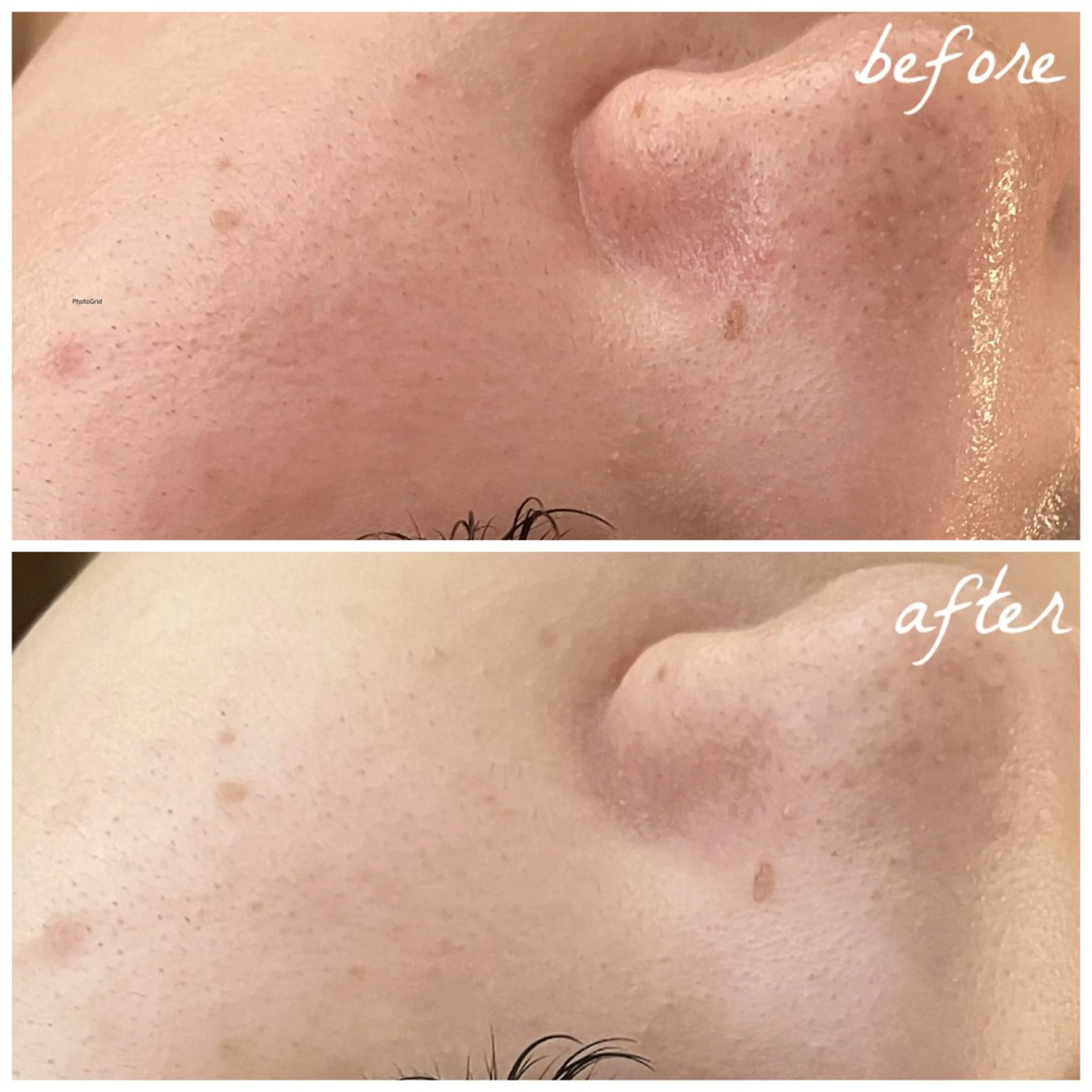 メンズ エステ メナード岐阜市茜部 杉浦のエステ・リラクイメージ