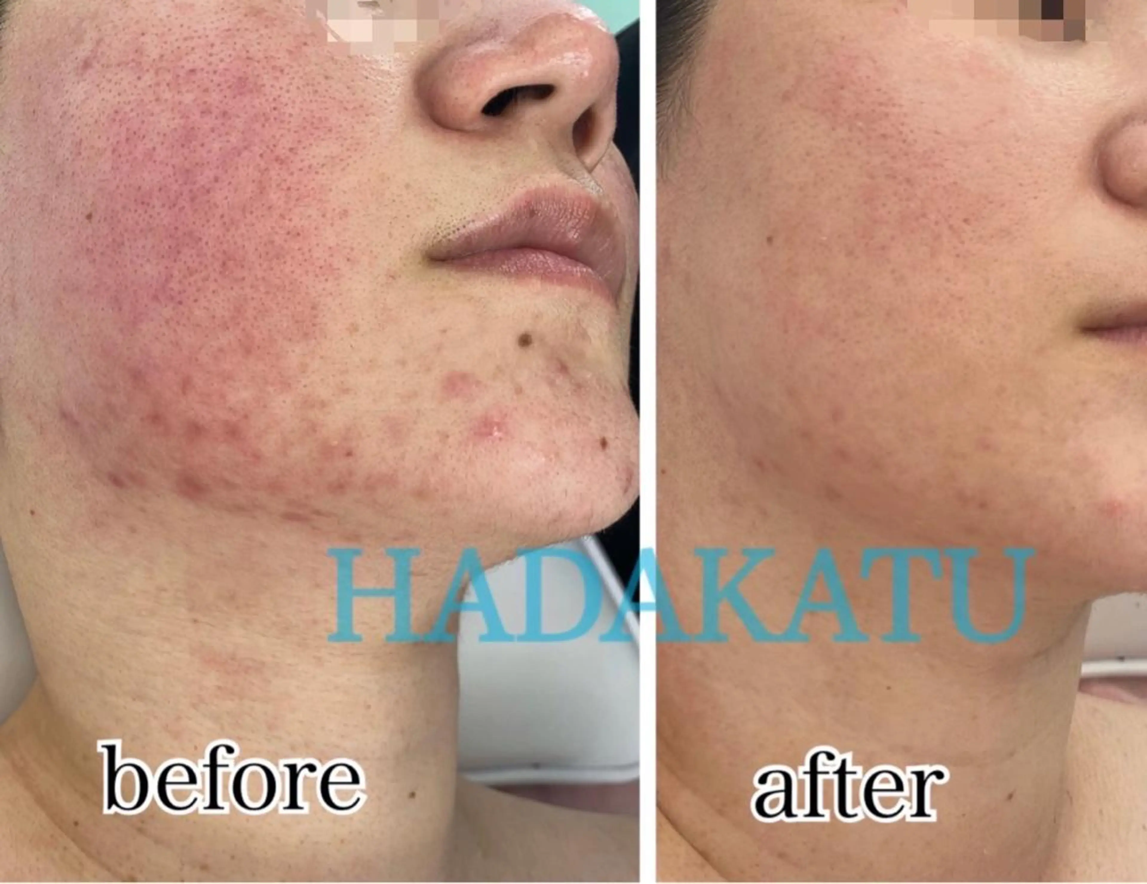 エステ 総合エステサロン 肌活のエステ・リラクイメージ