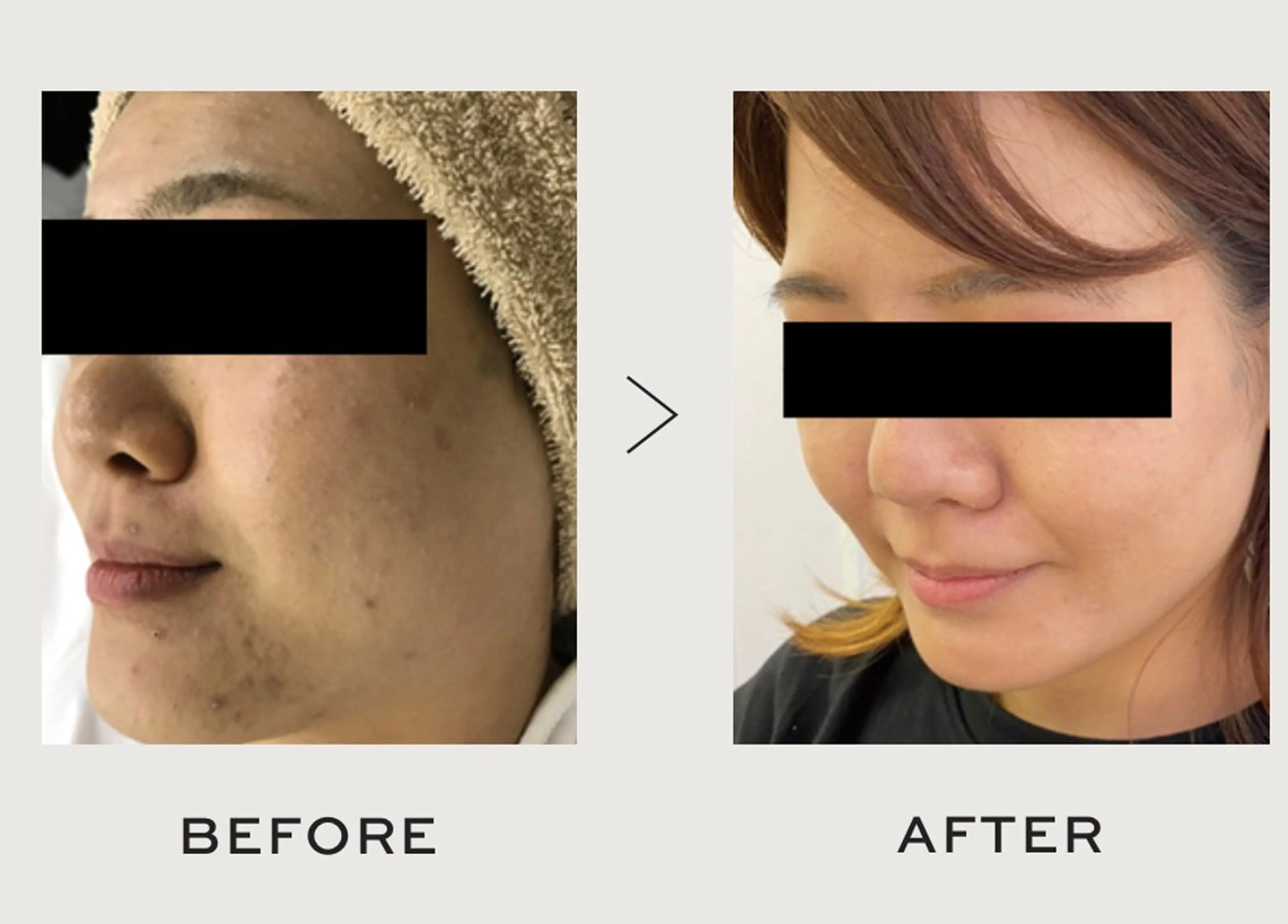 エステfreep takamoriのエステ・リラクイメージ