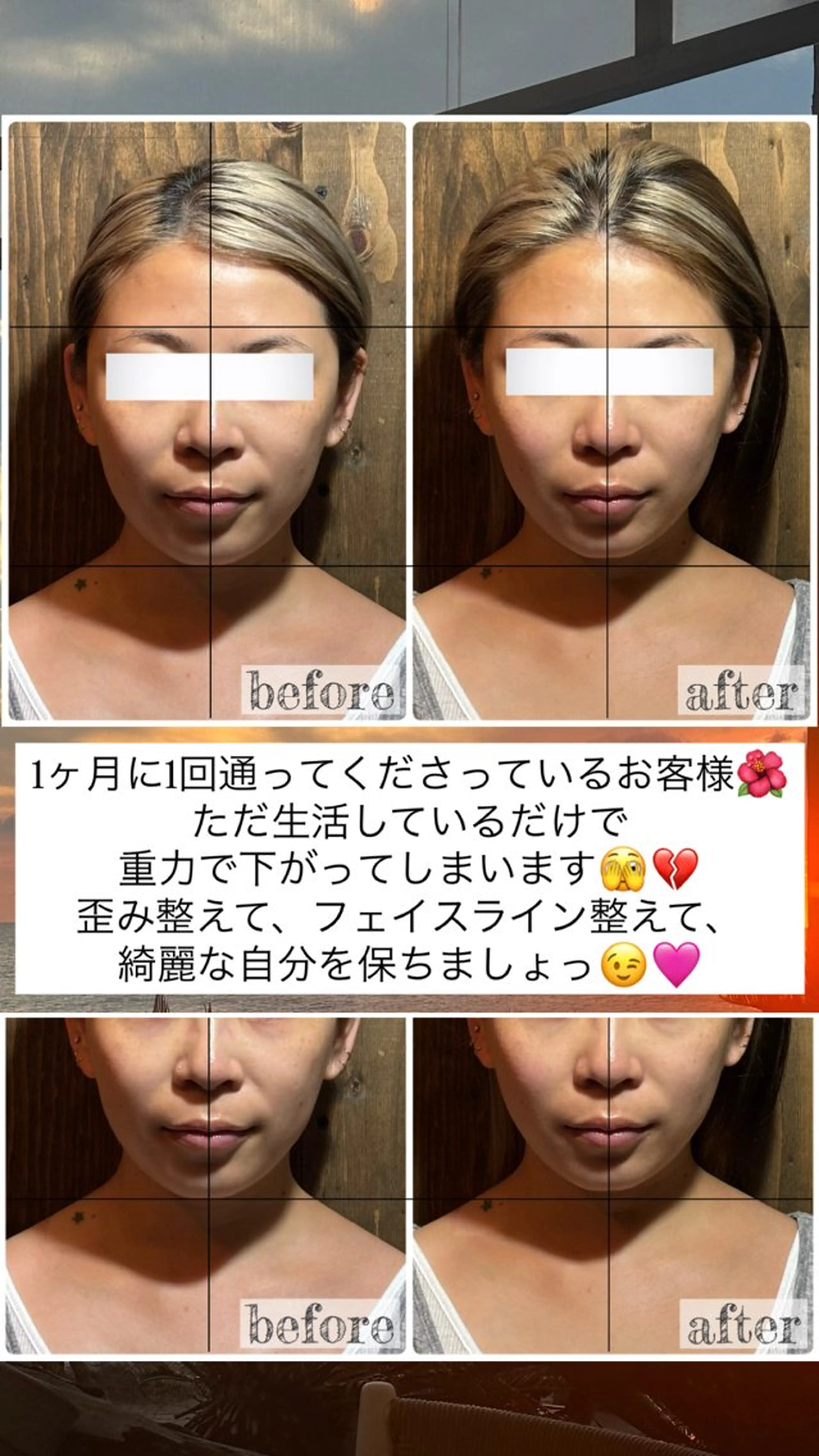 エステ リラク 💎後悔させない小顔 矯正💎イトヤマ🌱のエステ・リラクイメージ