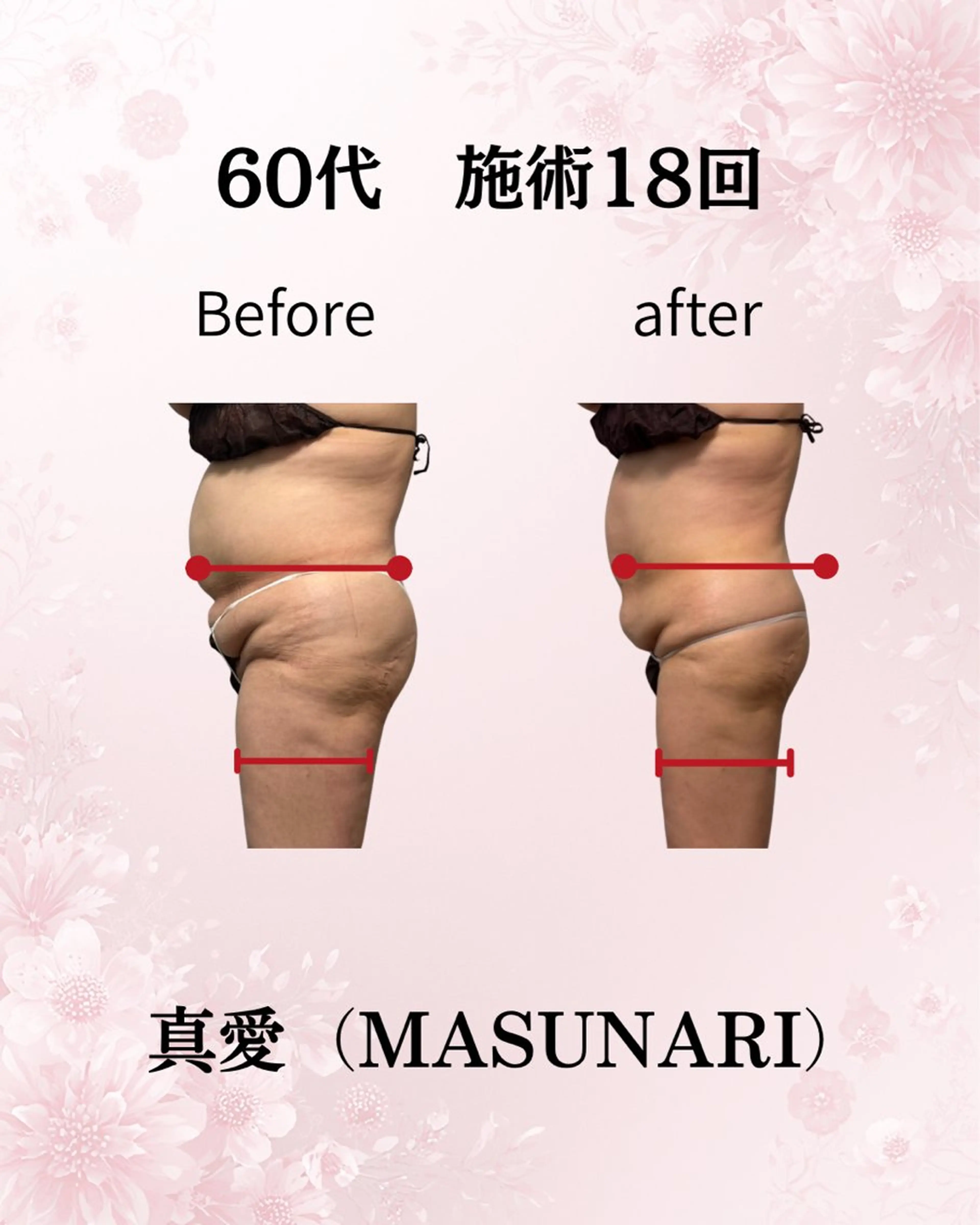 (初回限定) 上半身痩身お腹まわりボディケア・更年期太り！の写真