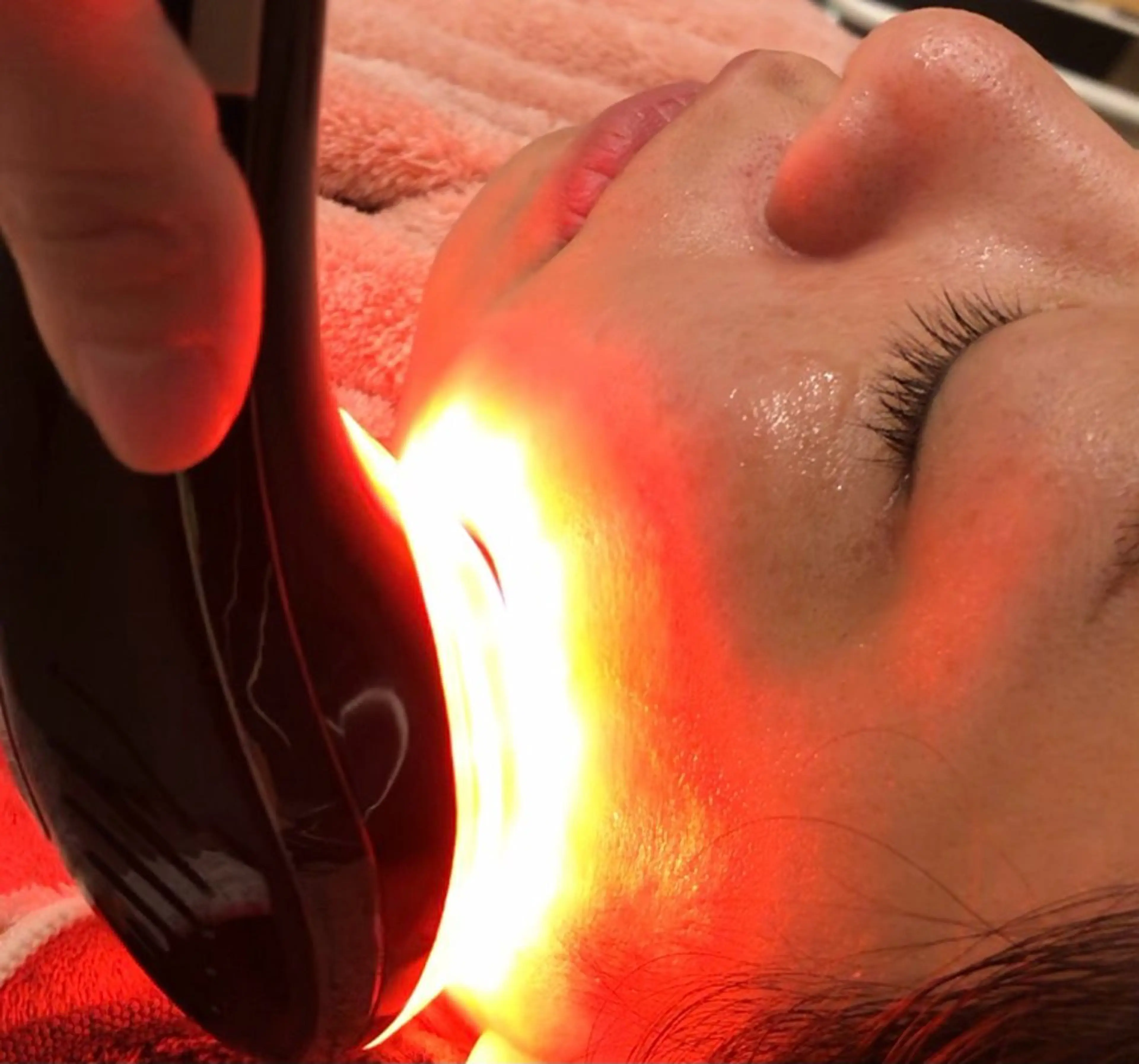 ◽︎高周波美顔器◽︎もちツヤ肌ウルトラパレスコース🌱の写真