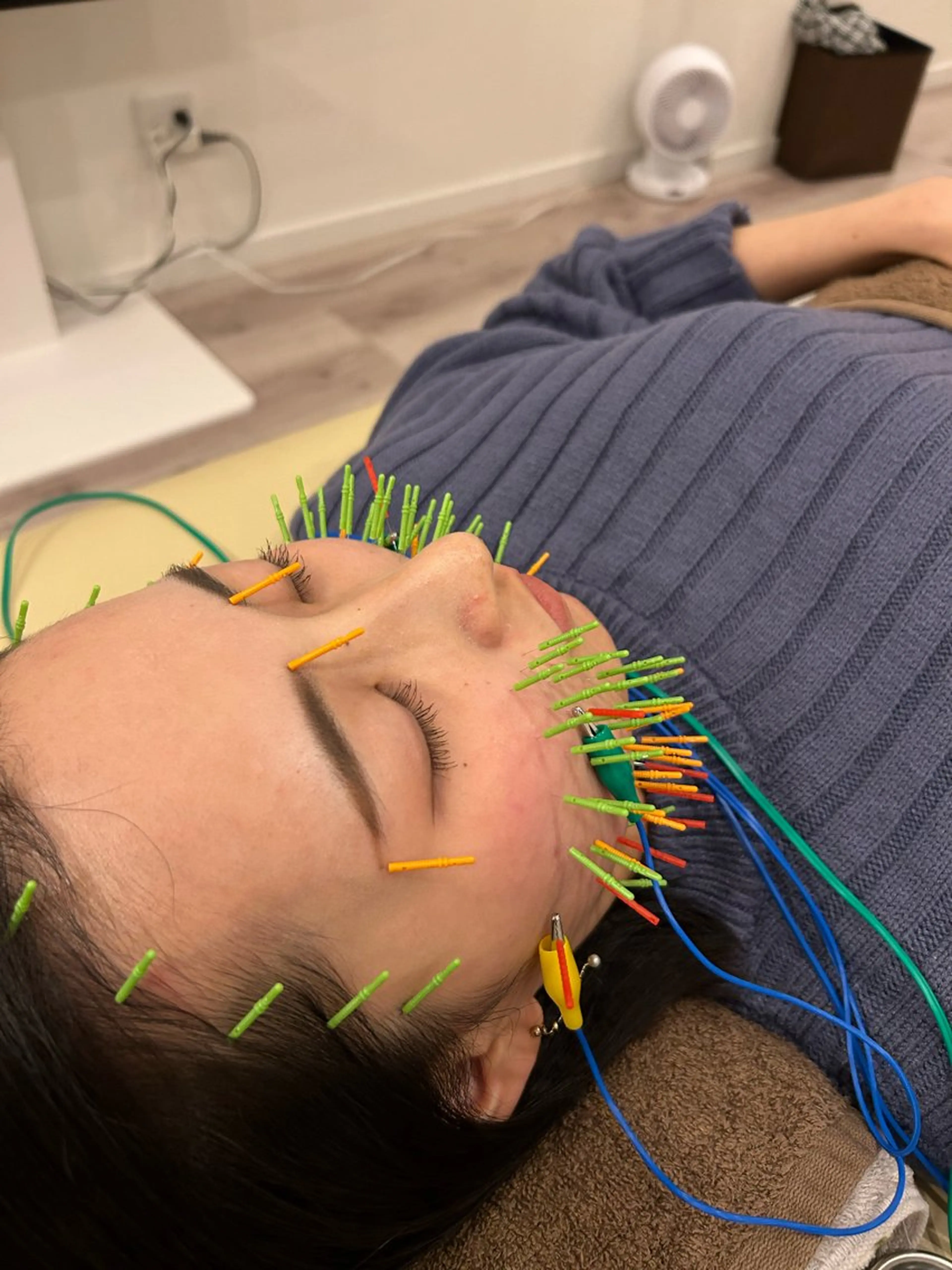 エステ リラク 肌質改善×美容鍼 ゆいのエステ・リラクイメージ