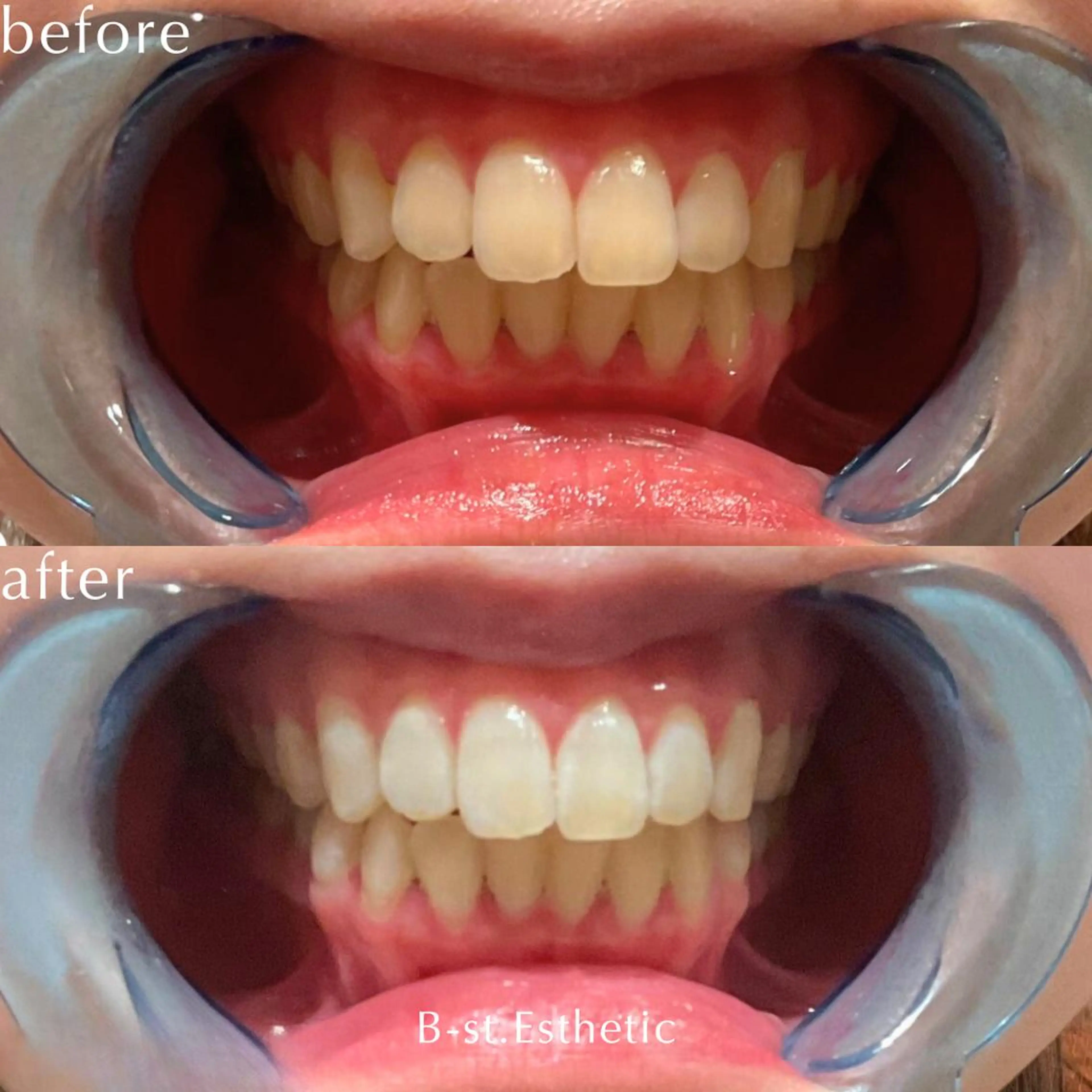 B-st. 下北沢のその他イメージ