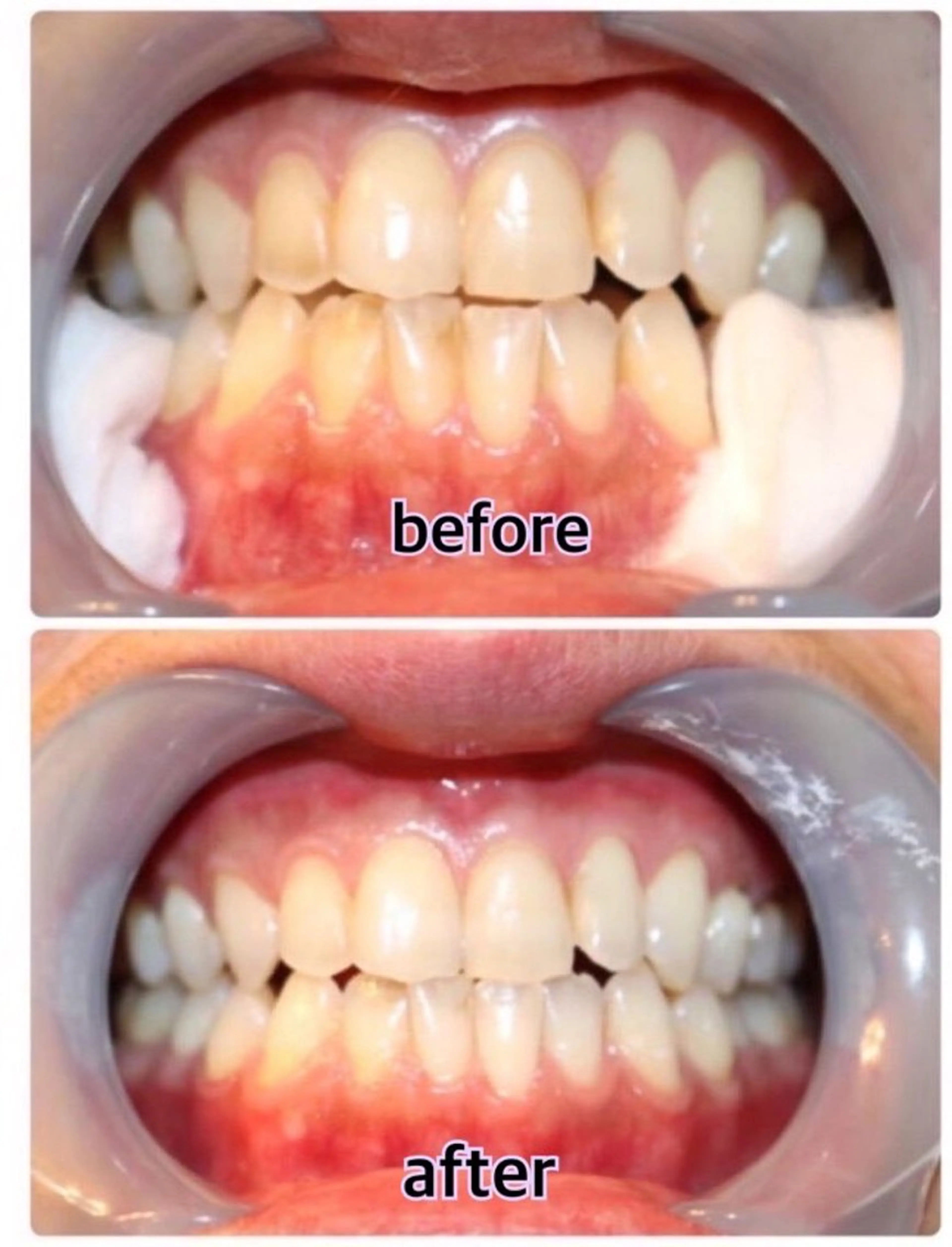 その他(ネイル) Nailbeauty marcherのネイルデザイン