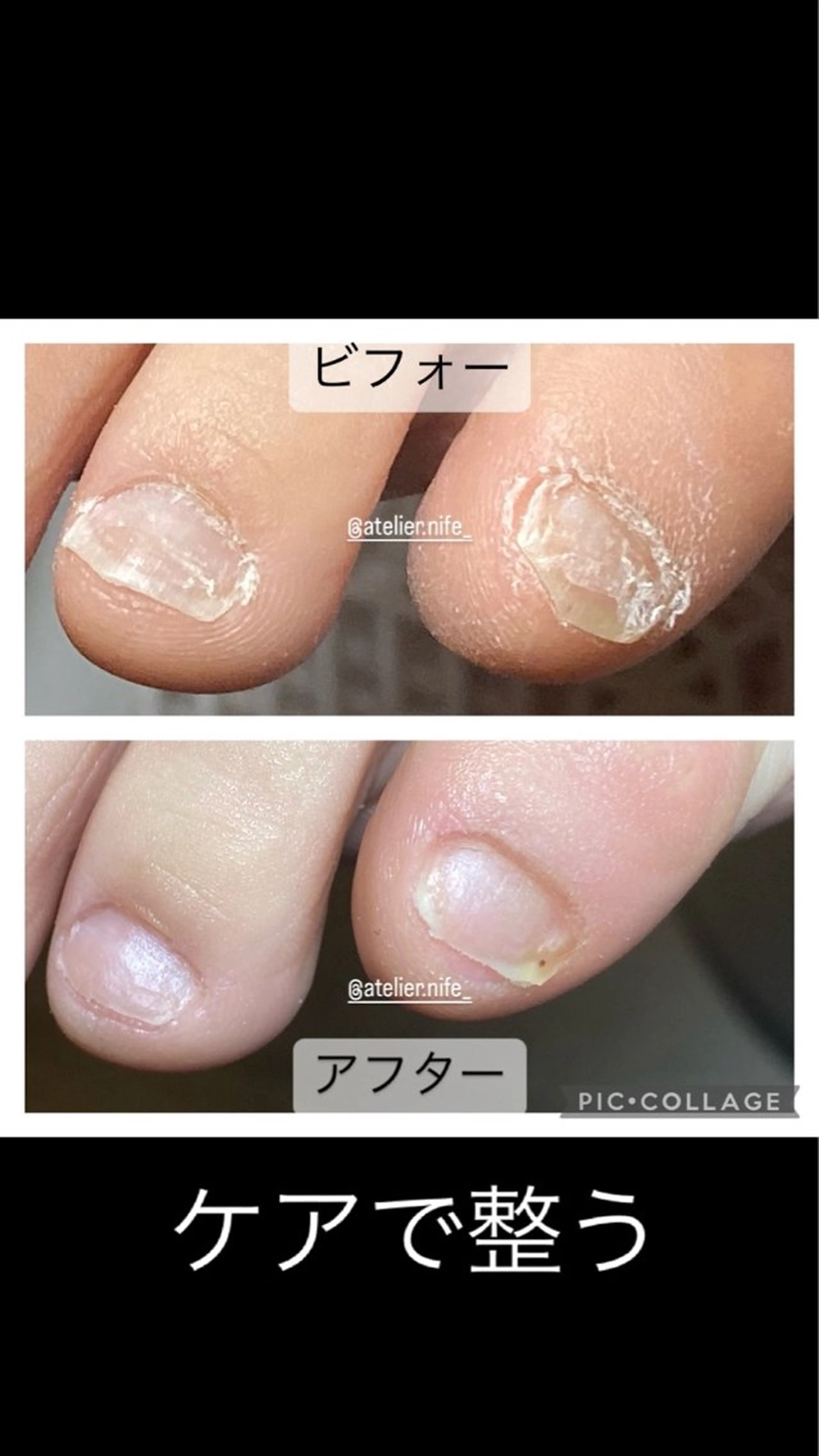 ネイル フットネイル atelier nife.のネイルデザイン