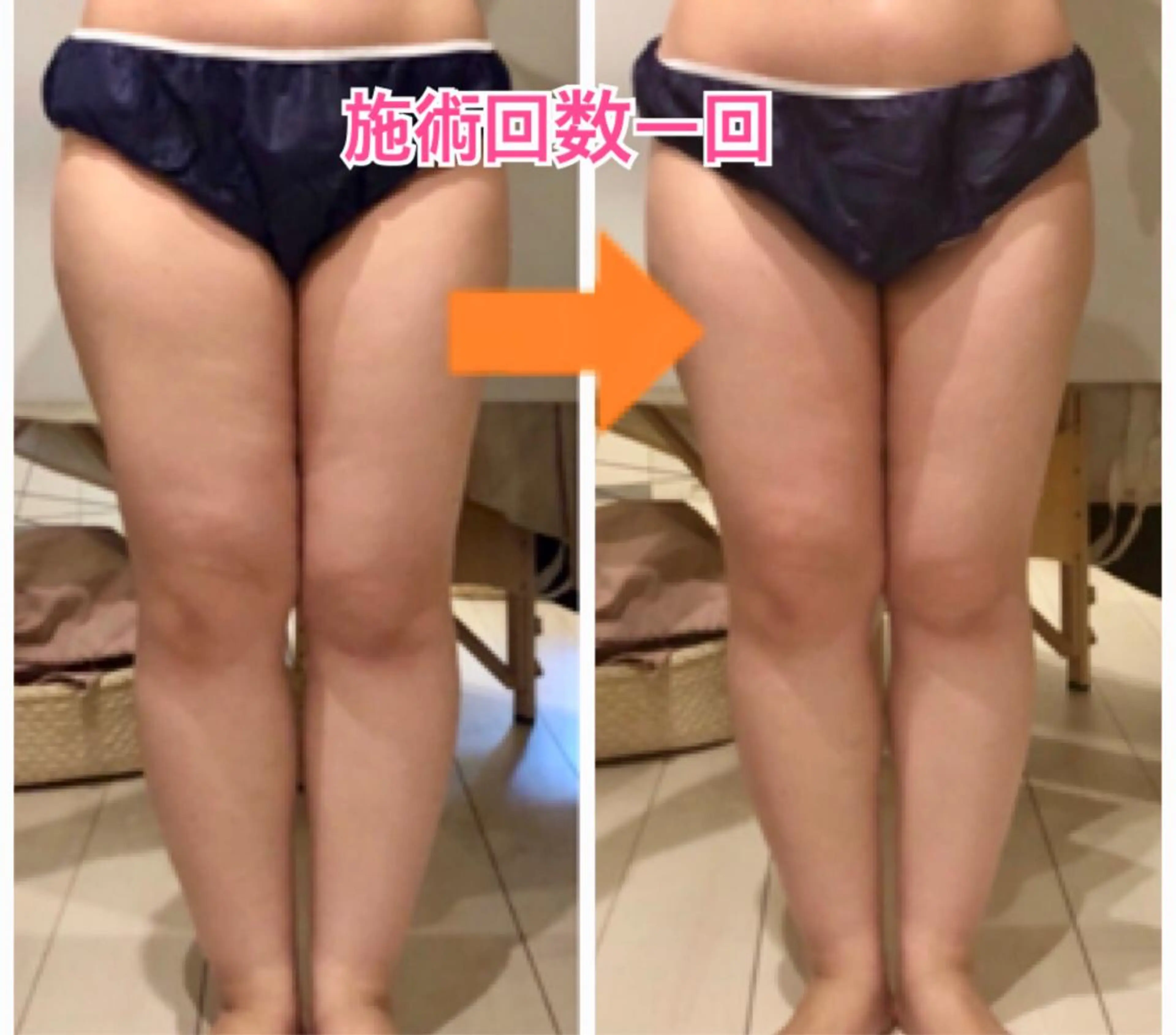 ロング カラー パーマ ヘアアレンジ メンズ キッズ ネイル マツエク・マツパ 痩身&ボディ 結果出し🌟丹野のエステ・リラクイメージ