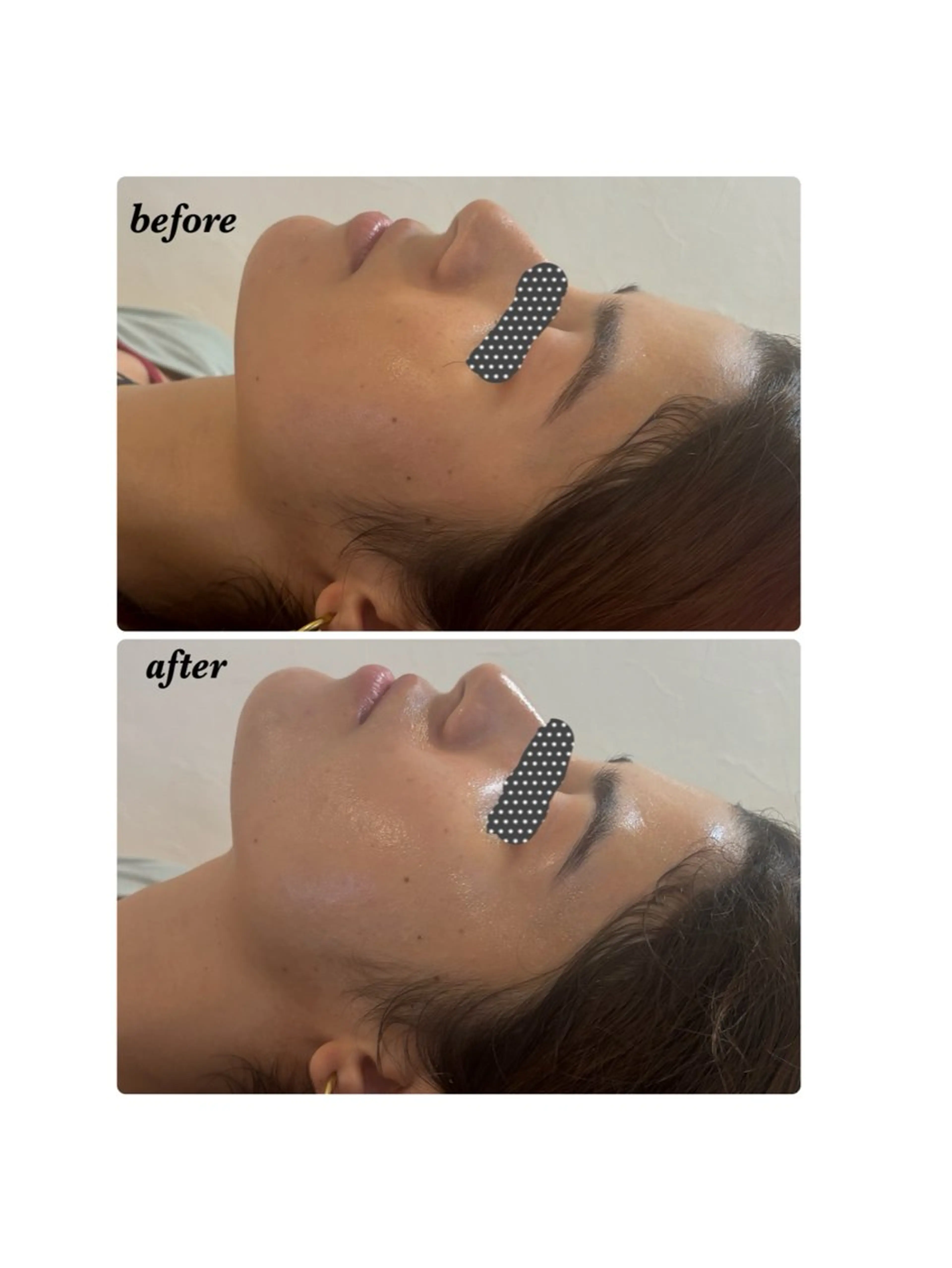 ハーブピーリング専門 毛穴洗浄❤️眉waxのエステ・リラクイメージ