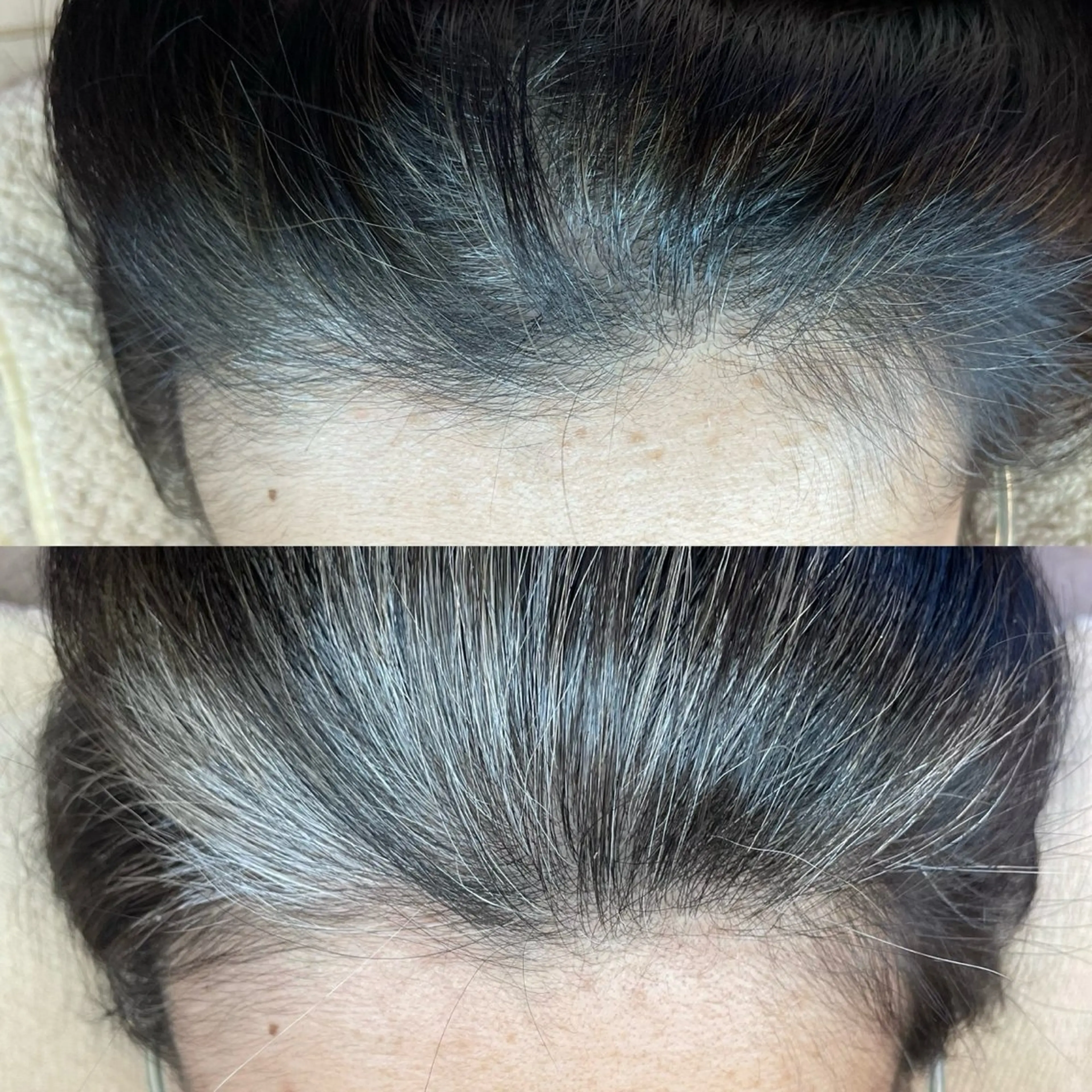 その他 毛穴・頭皮 専門店💪のその他イメージ