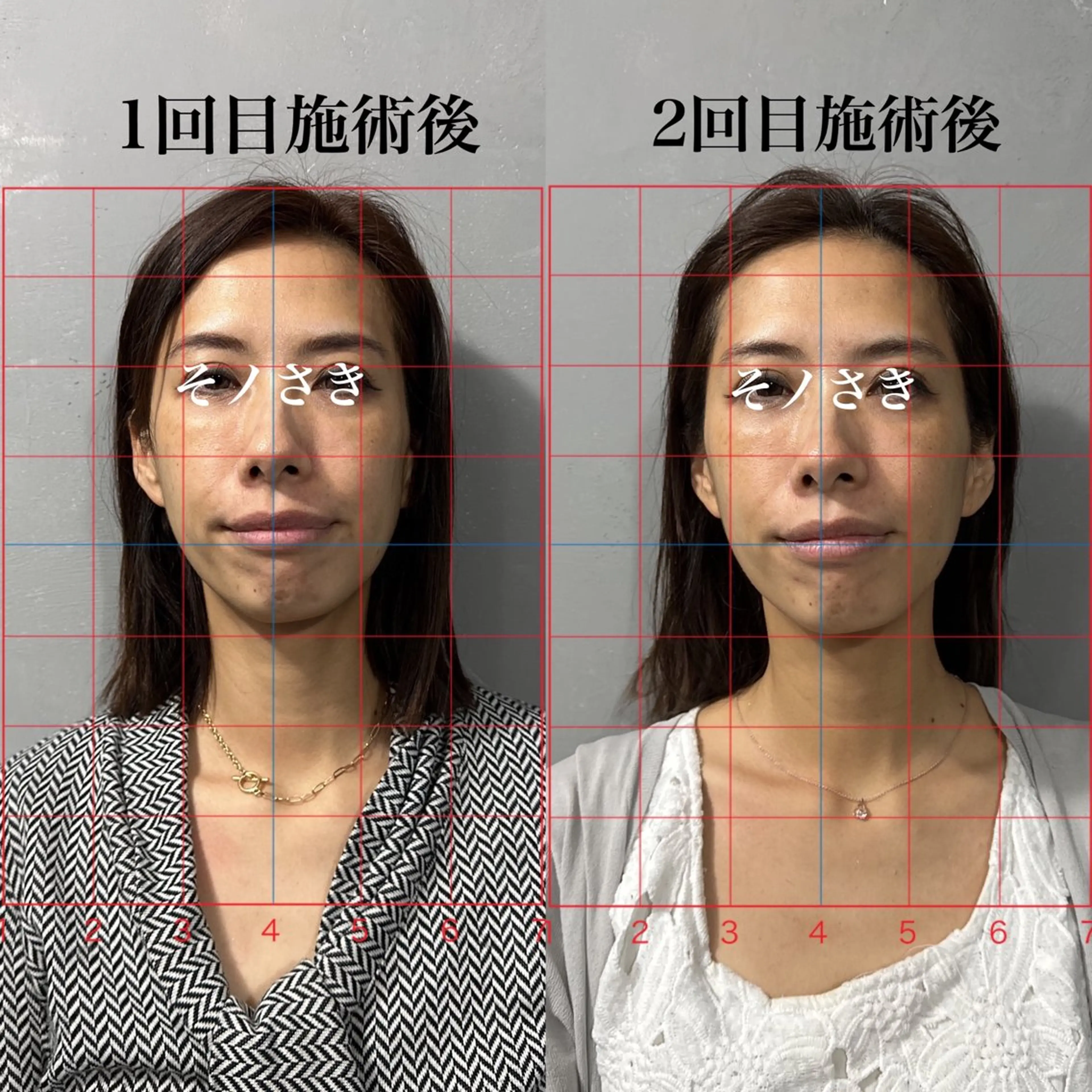 鍼灸整体専門サロン 島袋のエステ・リラクイメージ