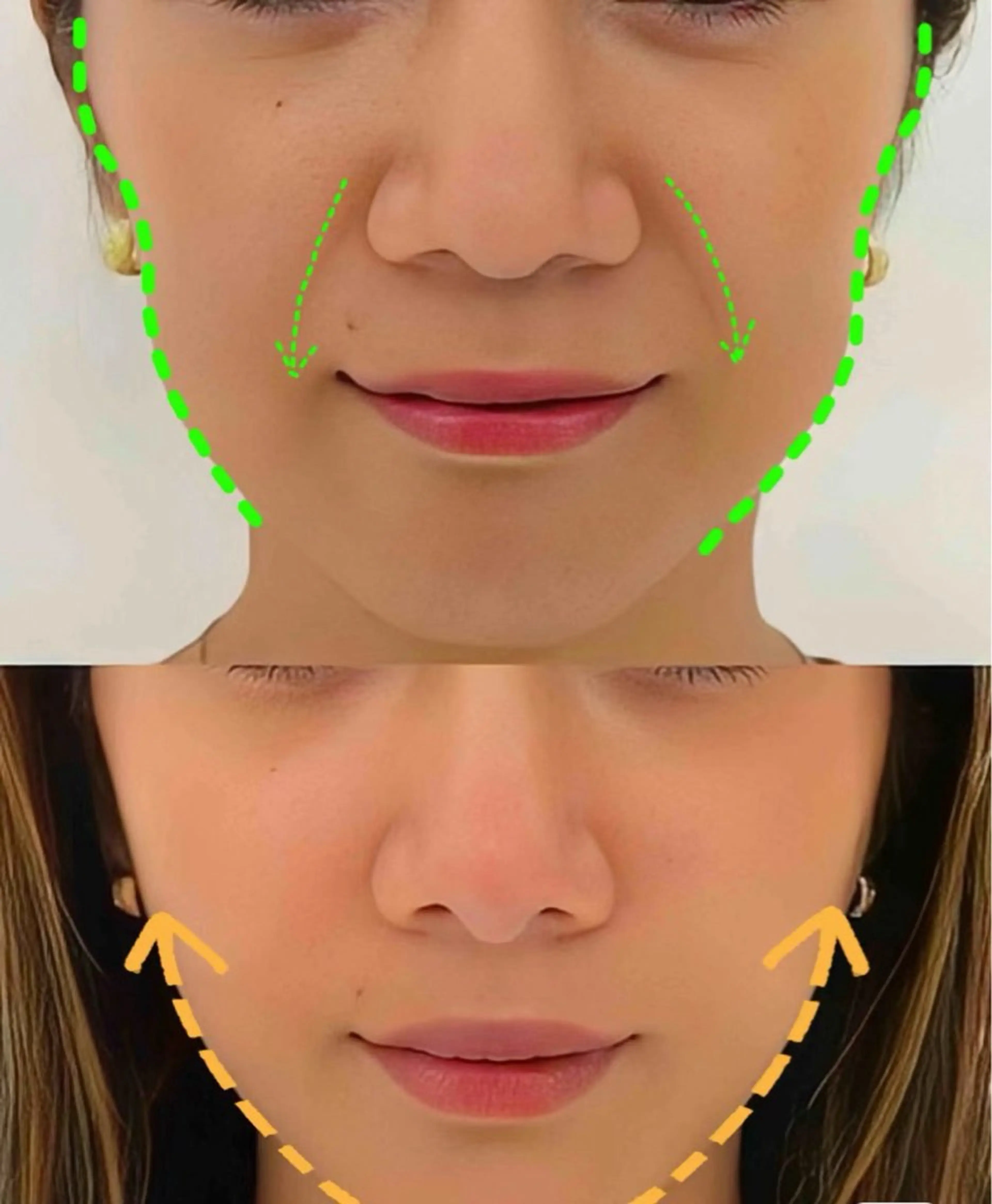 マツエク・マツパ 結婚式・ブライダル エステ aliaハーブ水光店 エステティシャン募集のエステ・リラクイメージ