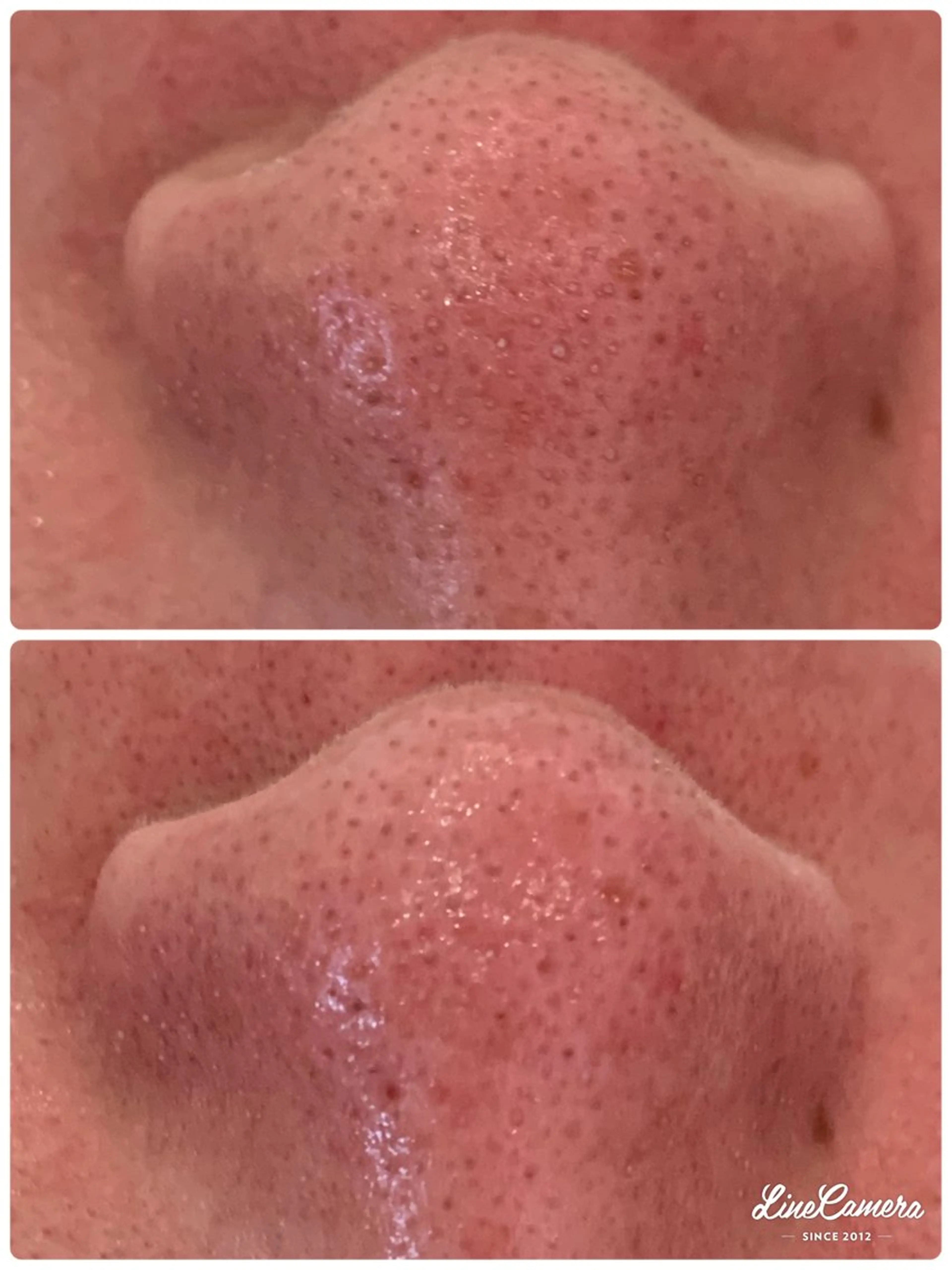 フェイシャルワックス 自然派エステファーノのその他イメージ