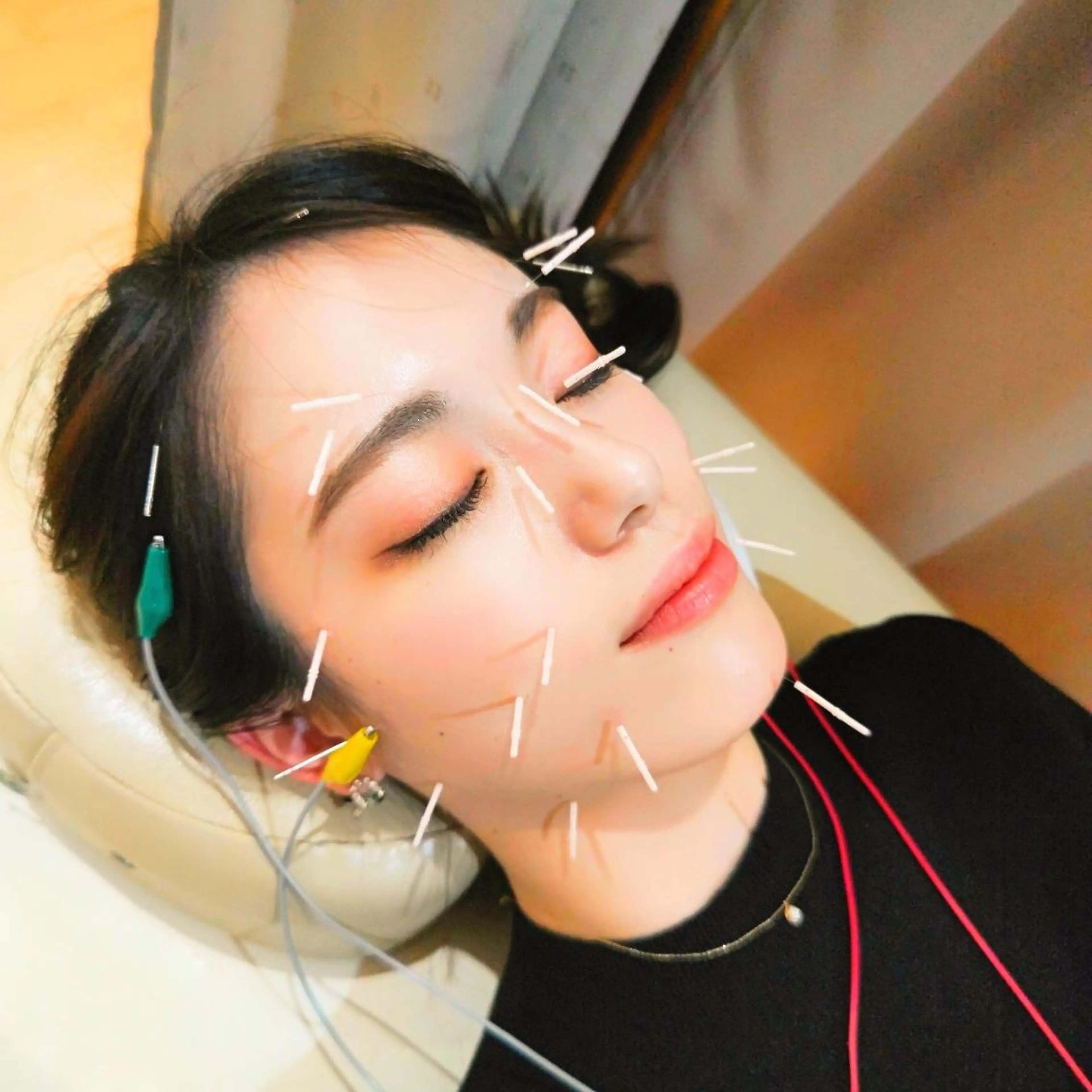 お顔のむくみたるみ 専門☆美容鍼小顔矯正のエステ・リラクイメージ