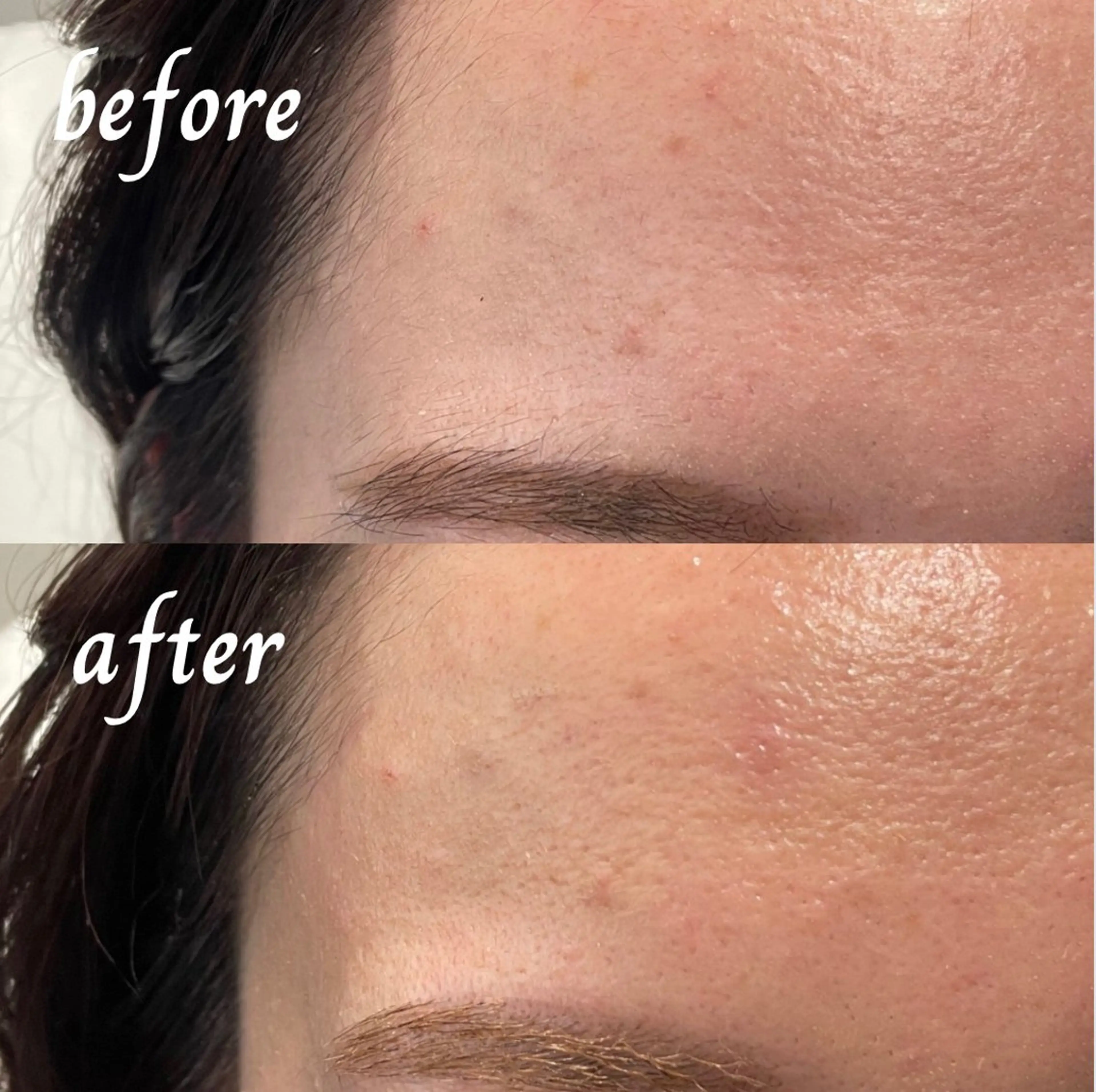 アイブロウ 眉毛ワックス脱毛 高野 紗南のエステ・リラクイメージ