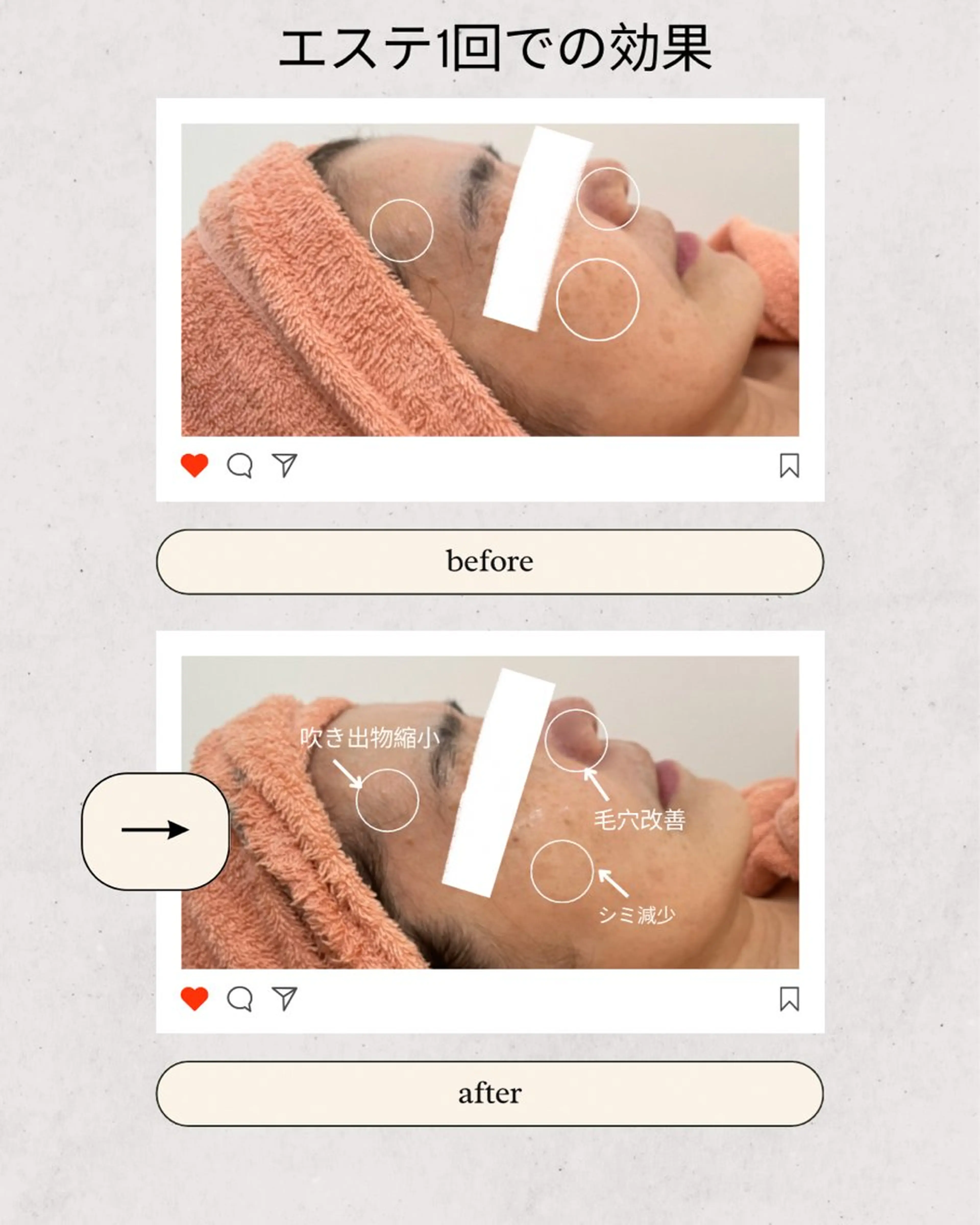 Amule anna🦋のエステ・リラクイメージ