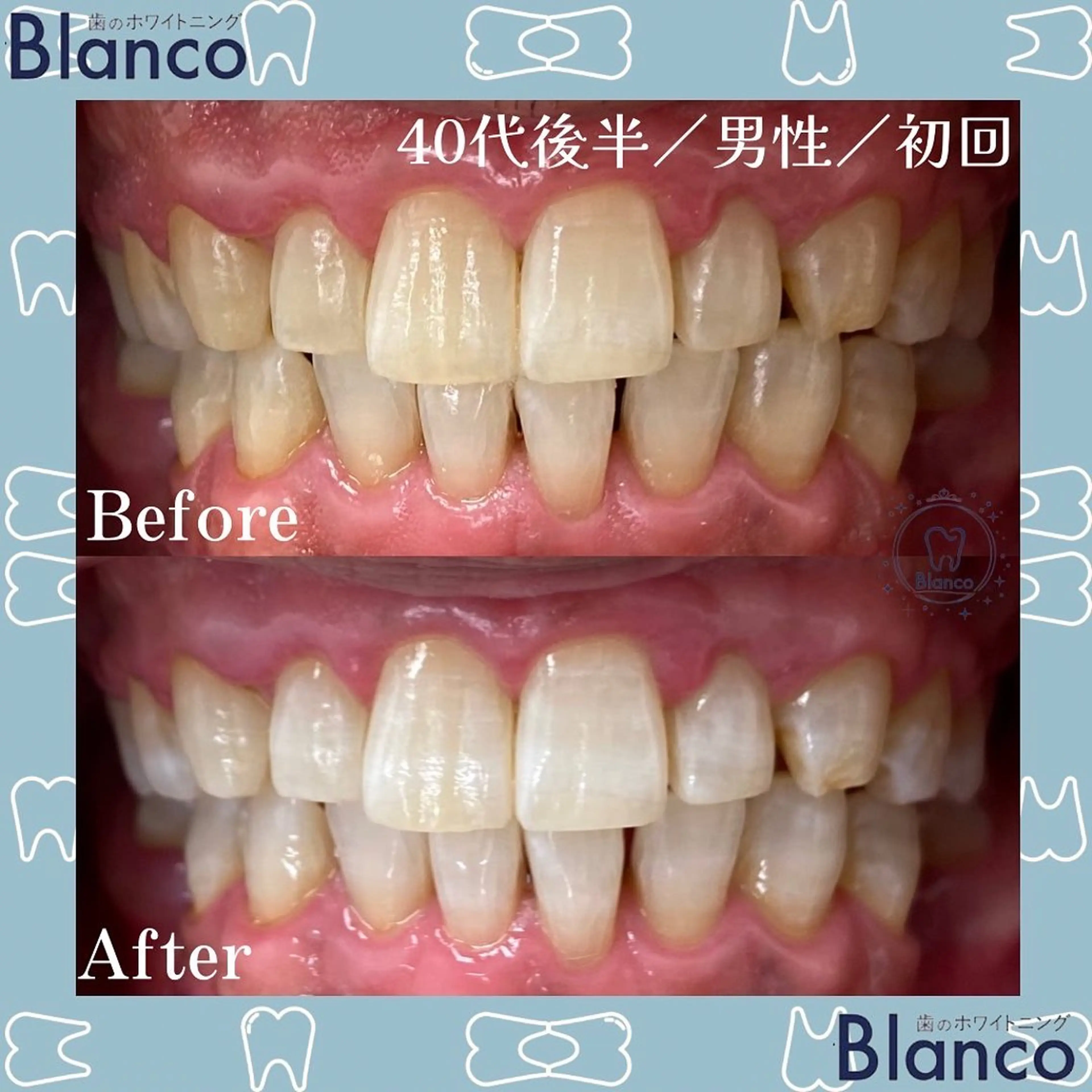 メンズ Blanco 川口駅前店のその他イメージ