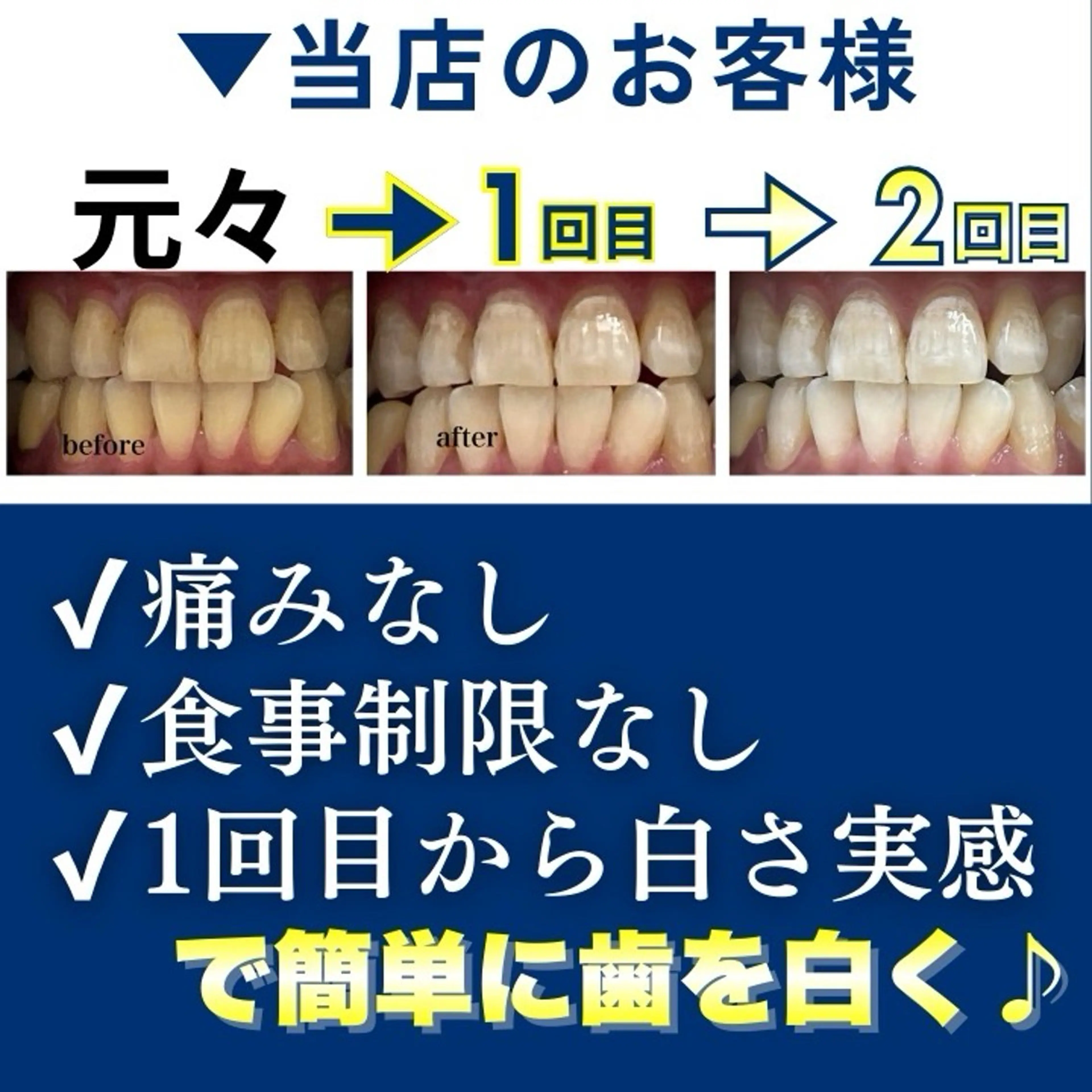 メンズ エステ ホワイトニング専門店 10年の実績|樟葉駅のエステ・リラクイメージ