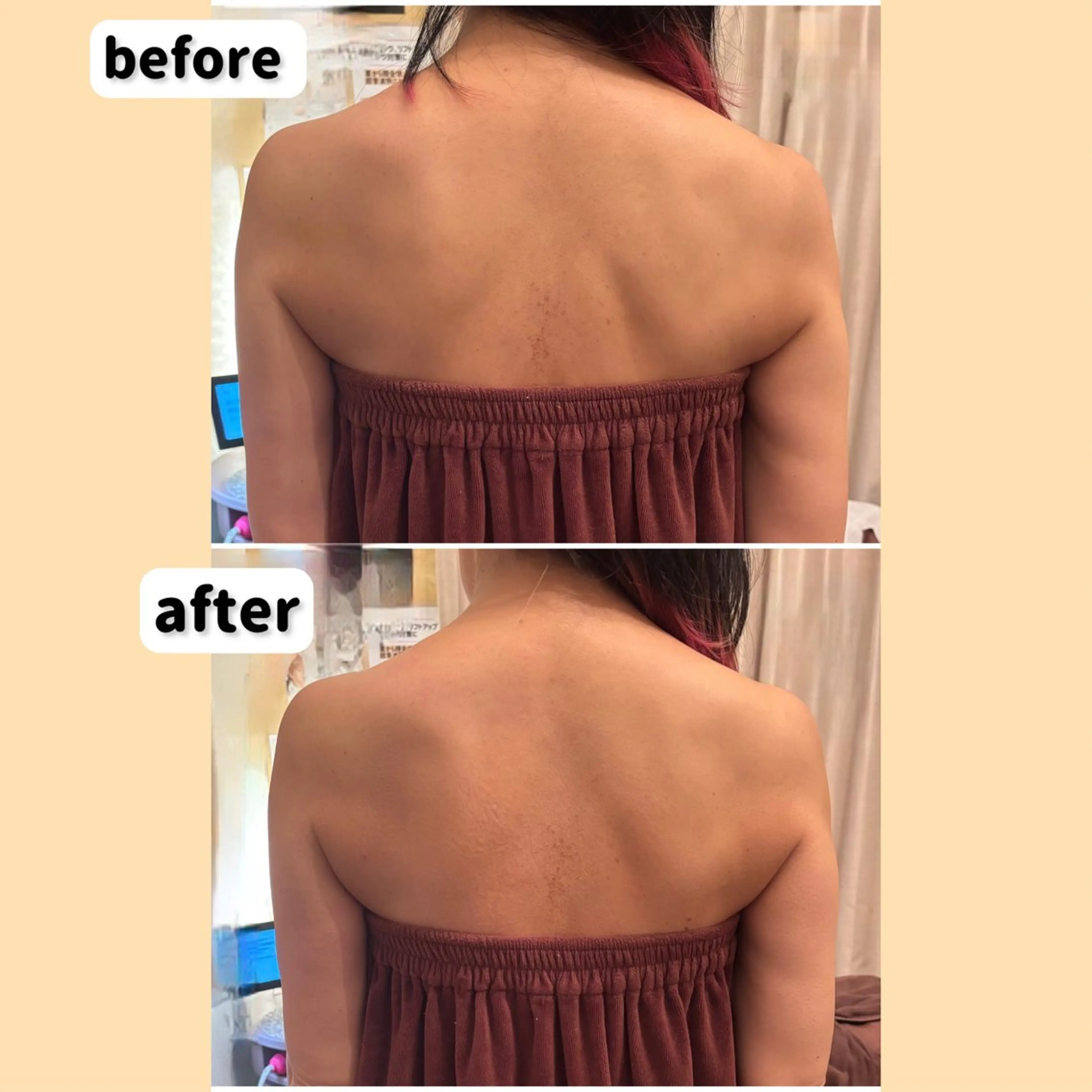 エステ 池田 愛のその他イメージ