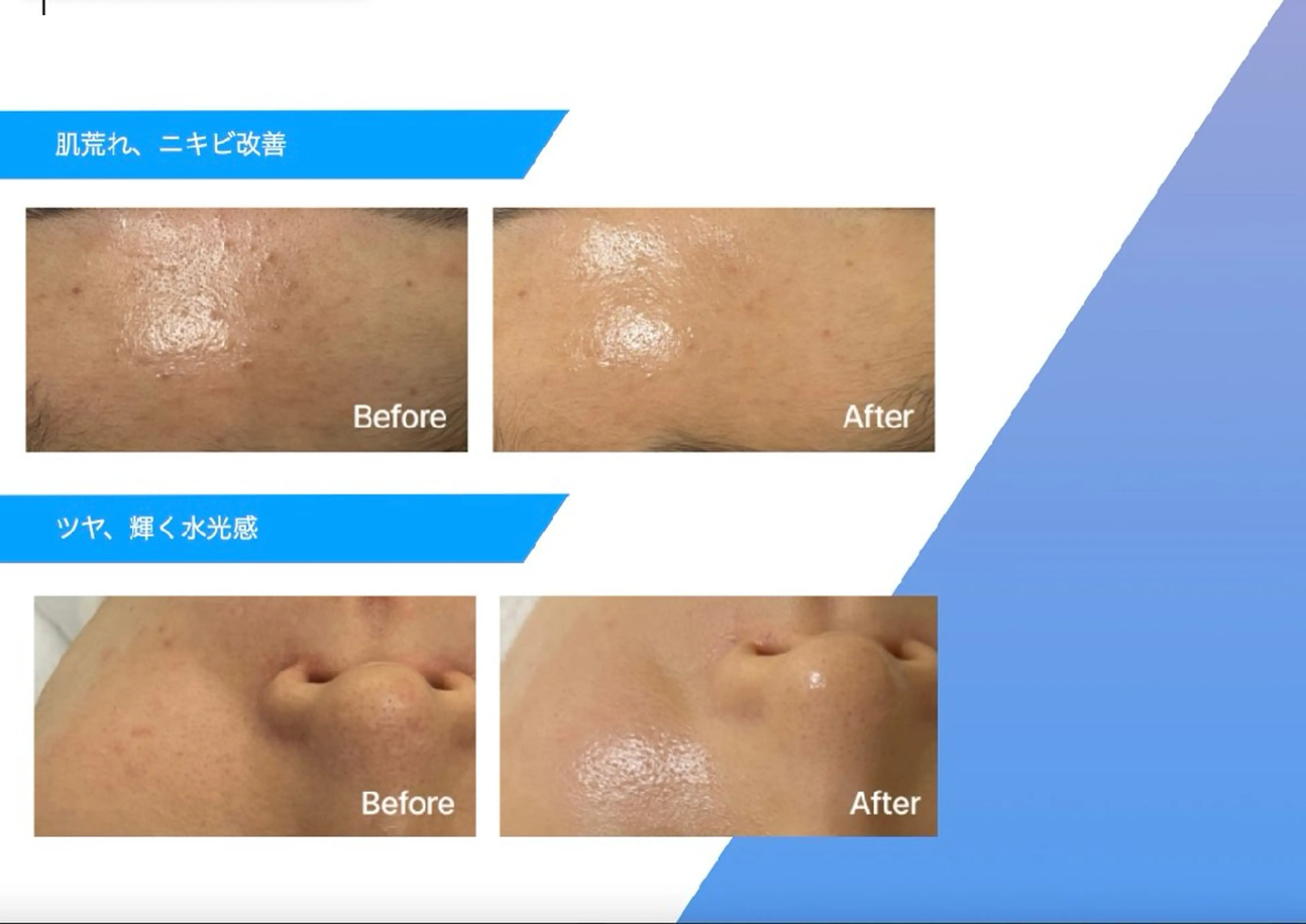 レティティア秋葉原店 Yoshizawaのエステ・リラクイメージ