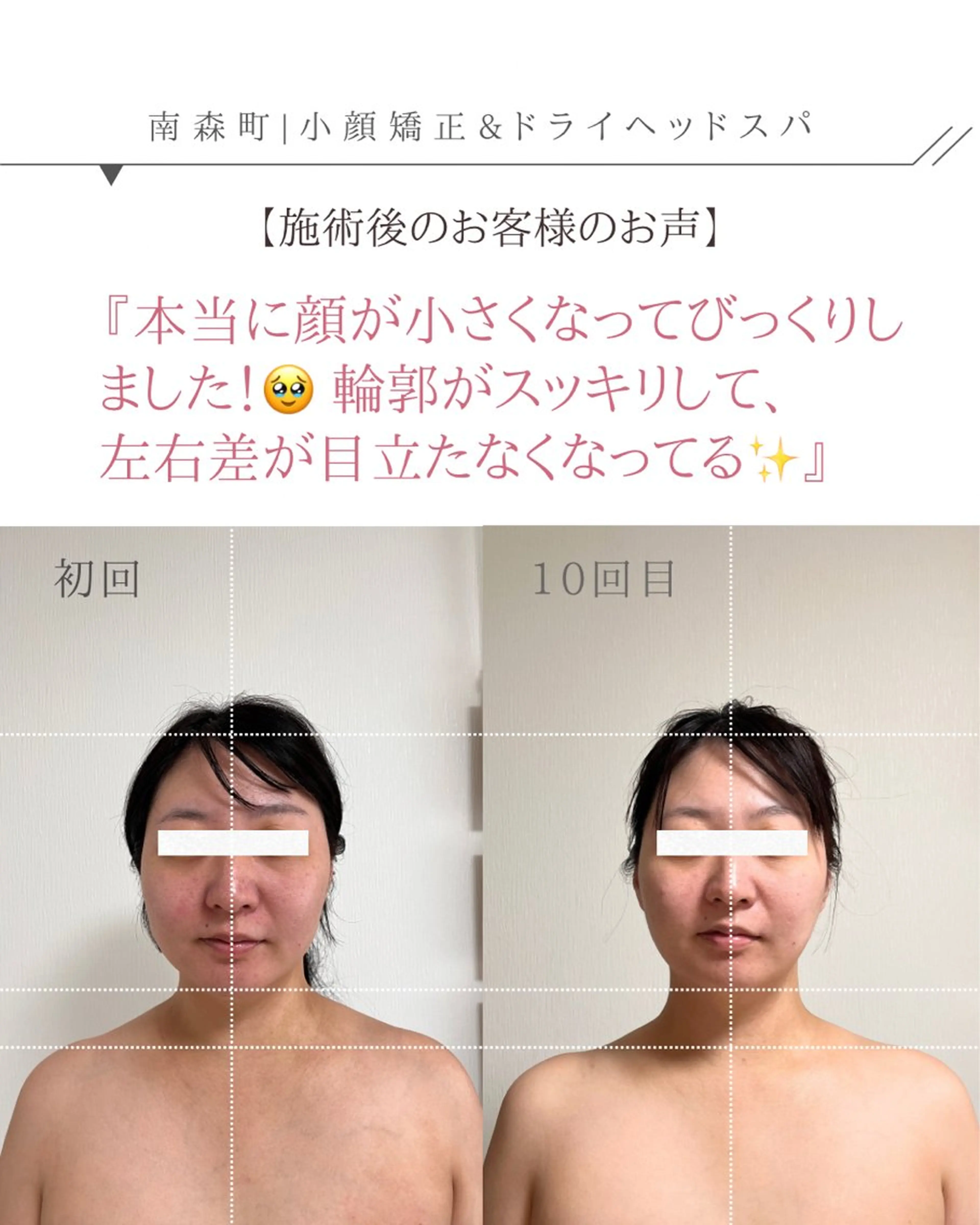 🌿 30代限定 3ヶ月間（6回来店条件）90分【顔むくみ解消/の余白をなくす小顔ヘッドスパ】の写真