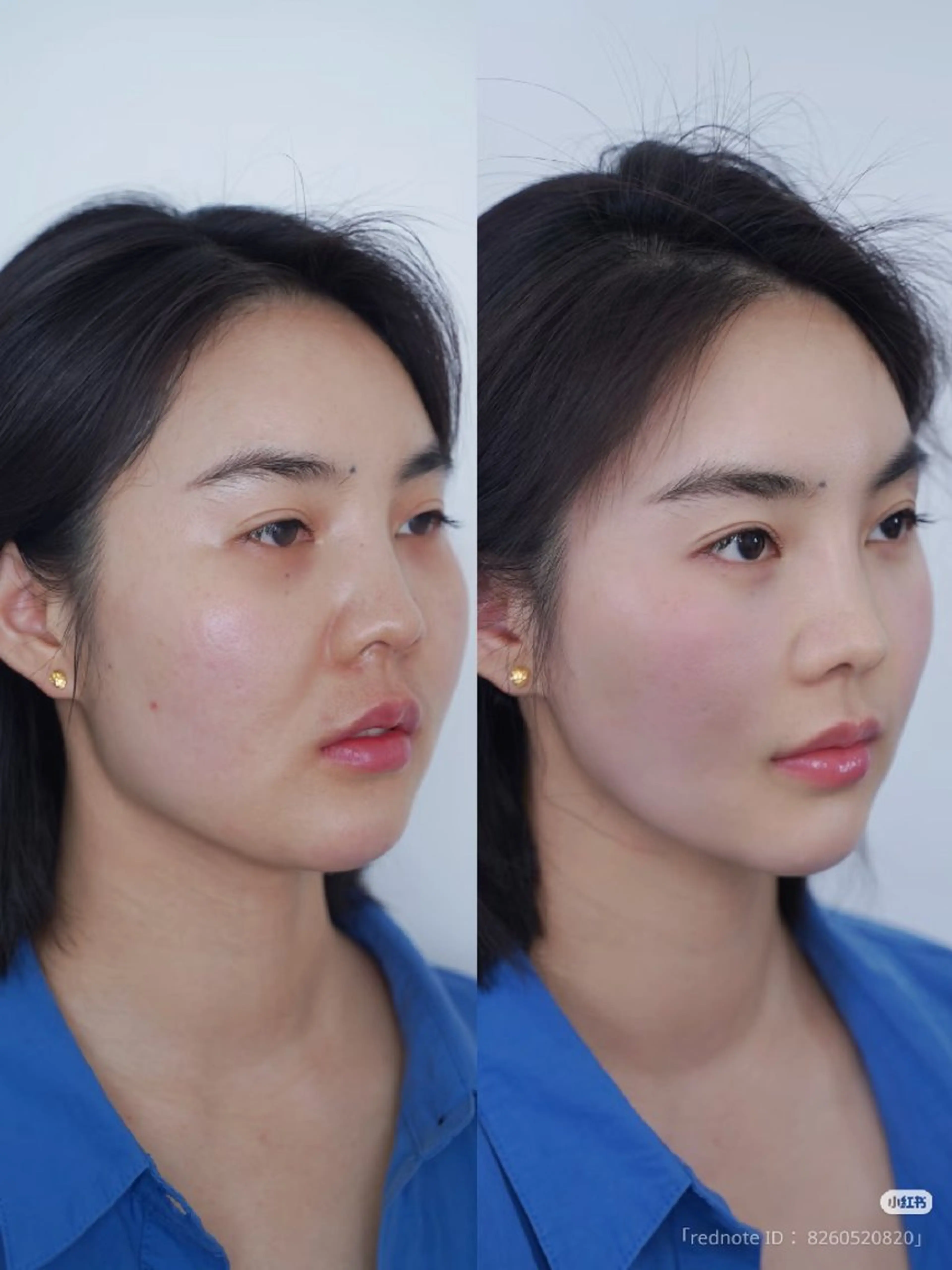 その他 aliaハーブ水光店 エステティシャン募集のエステ・リラクイメージ