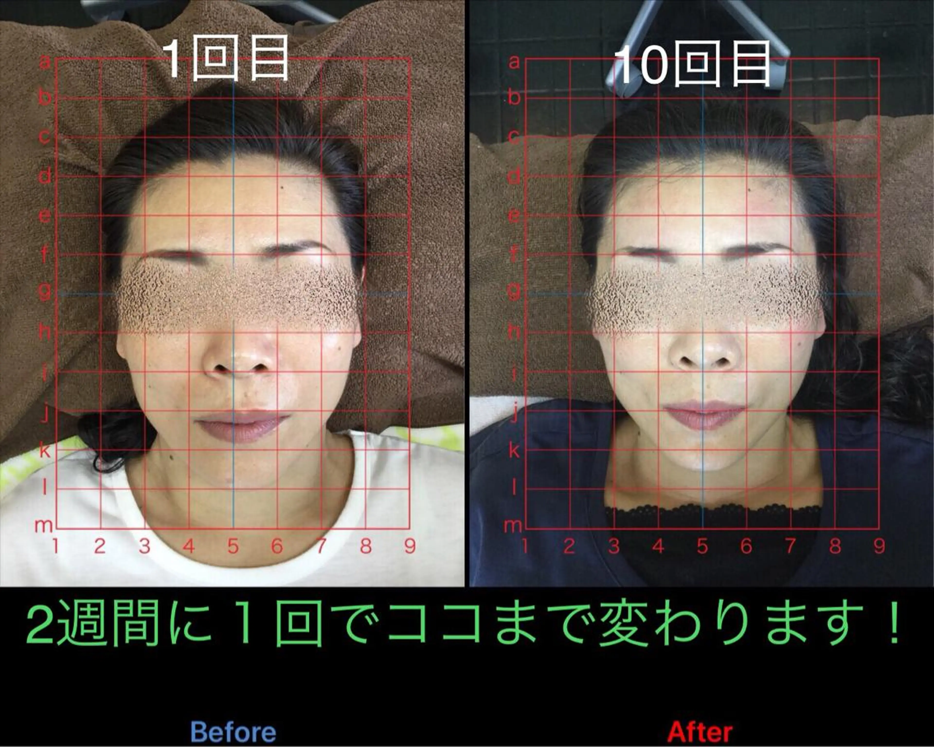 小顔矯正/美容整体 /骨盤矯正✨+Mi2のエステ・リラクイメージ