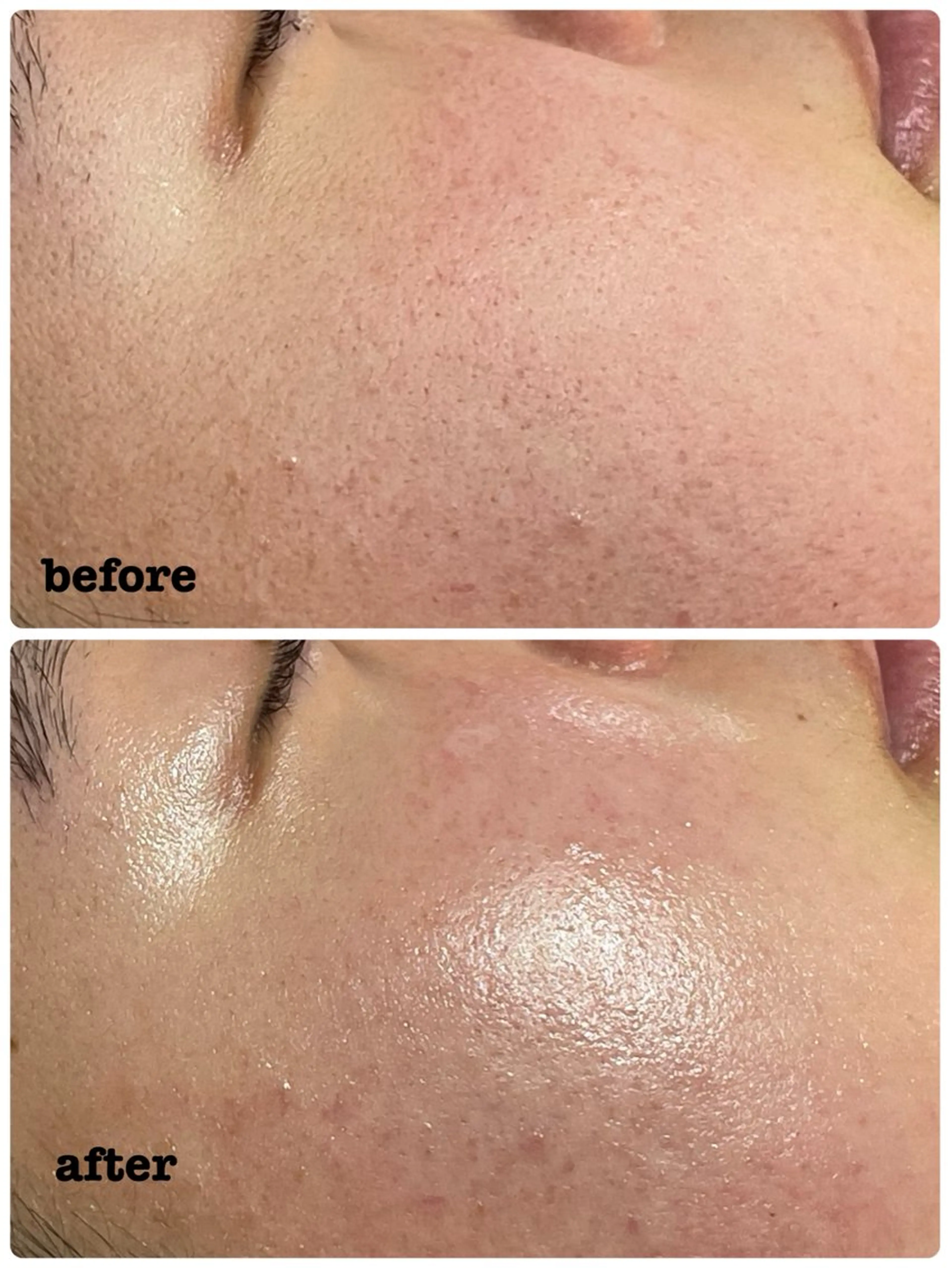 エステ 肌質改善専門店/絹々(きぬ)所属・心満たされる ハーブピーリング絹々のエステ・リラクイメージ