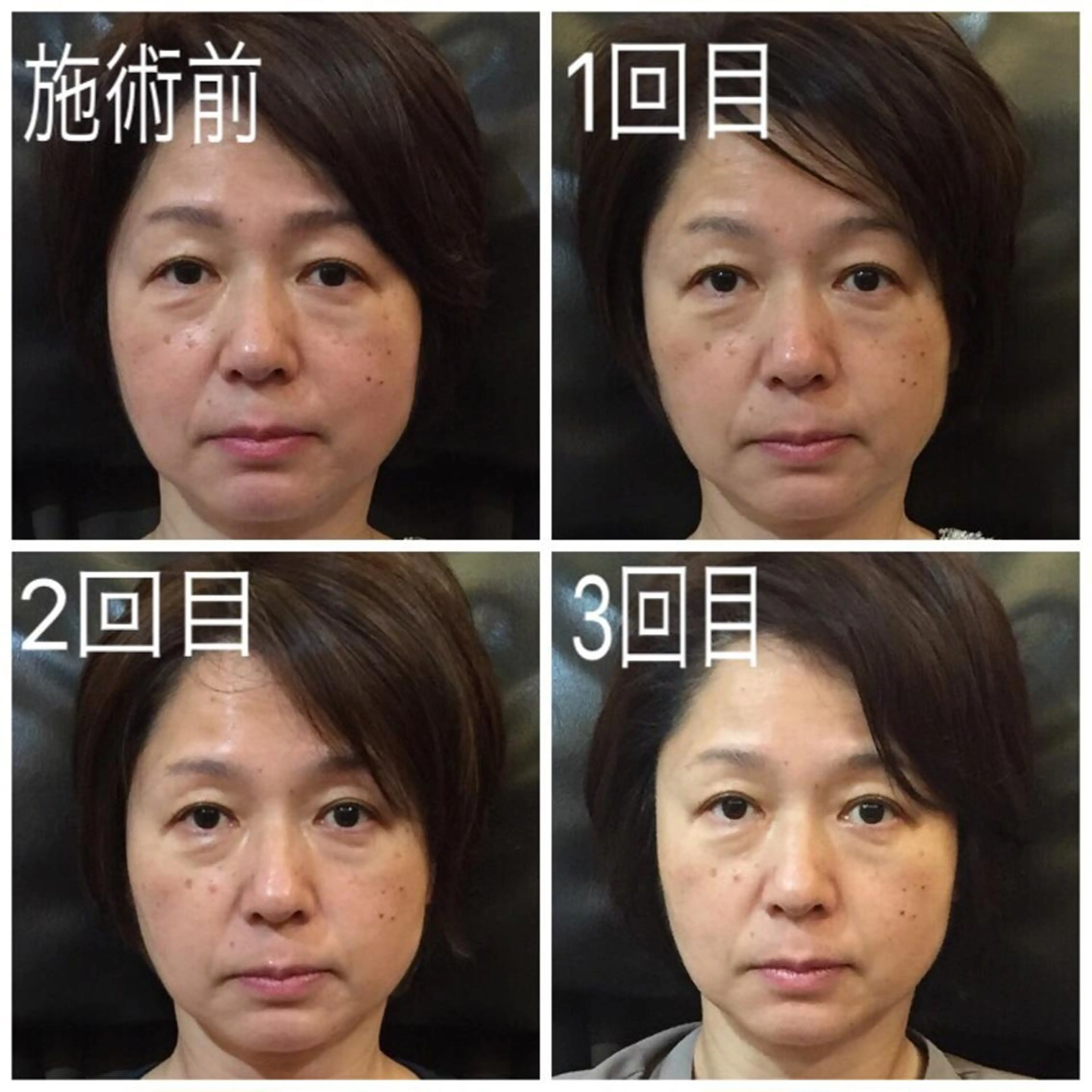 マナビス& ボワールのネイルデザイン