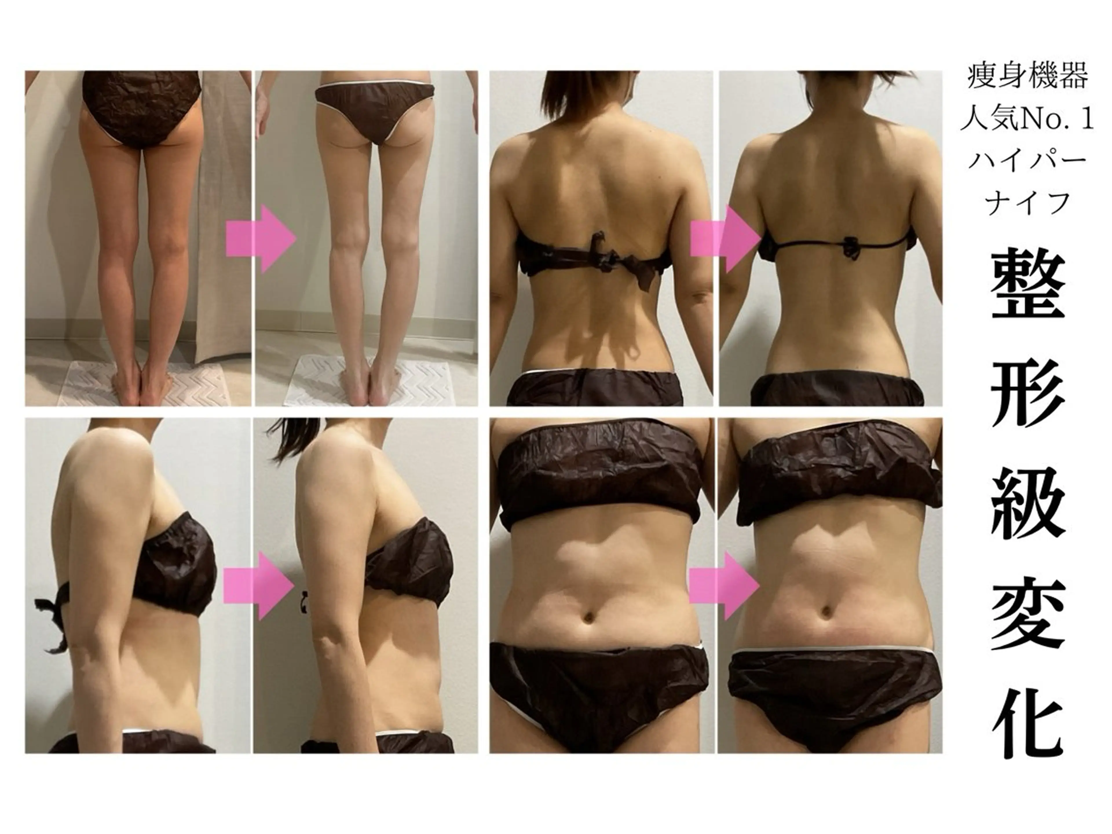 エステ LiLL by Andre beauty所属・LiLL 熊本のエステ・リラクイメージ