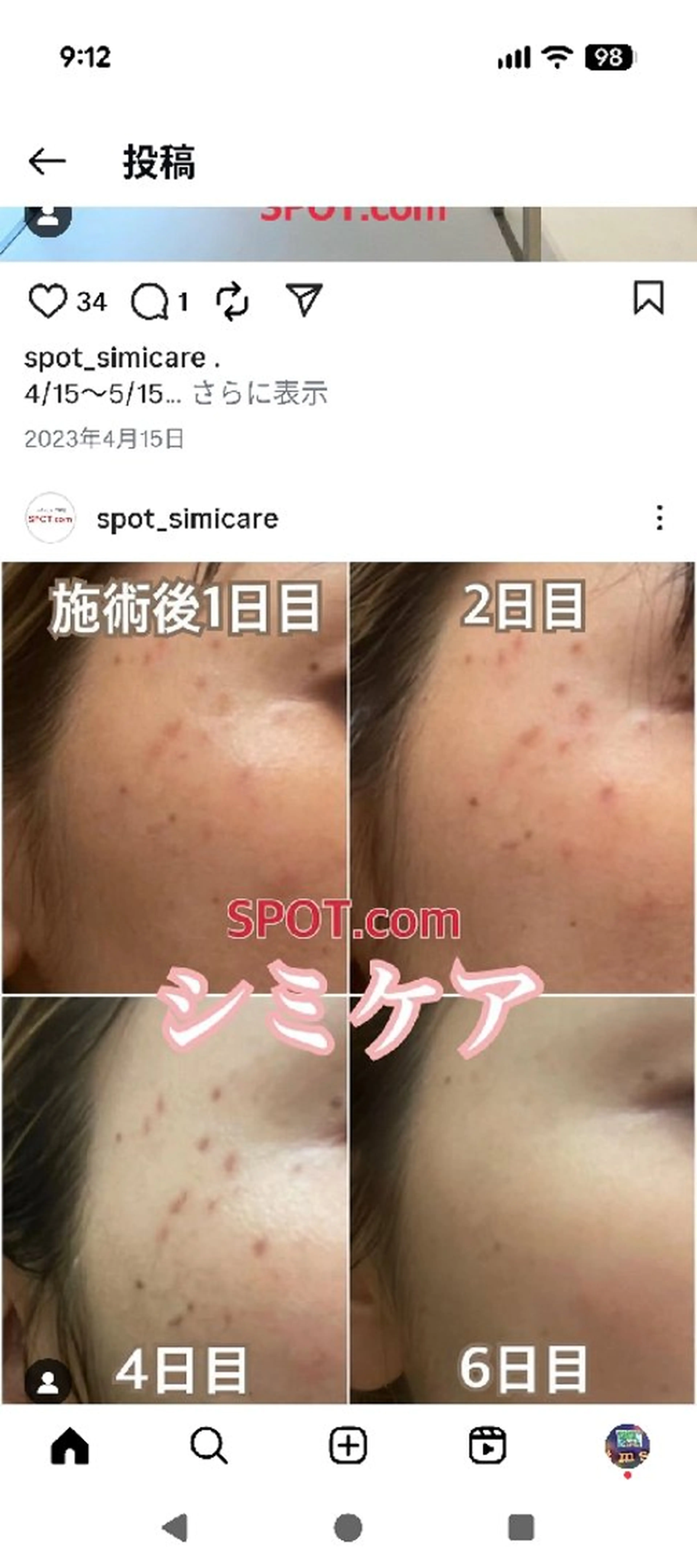 SPOT.com  シミケア専門店のエステ・リラクイメージ