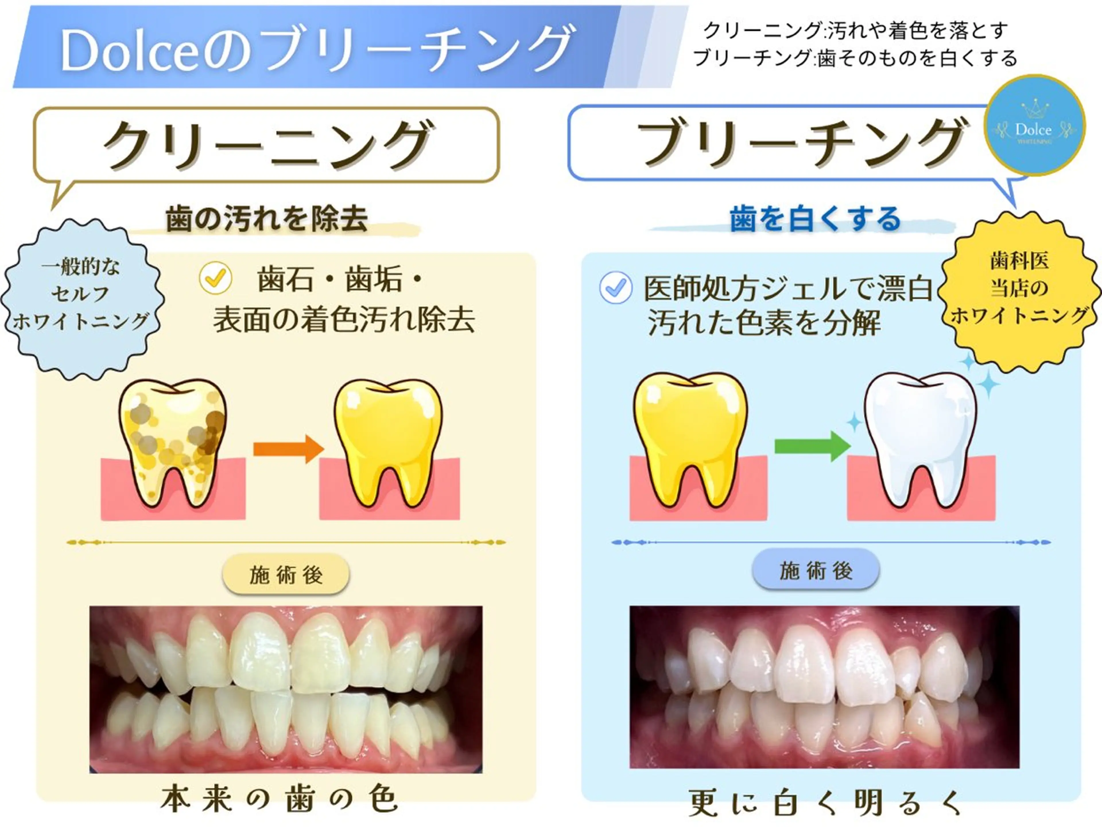 セルフホワイトニング Dolce八王子店のその他イメージ