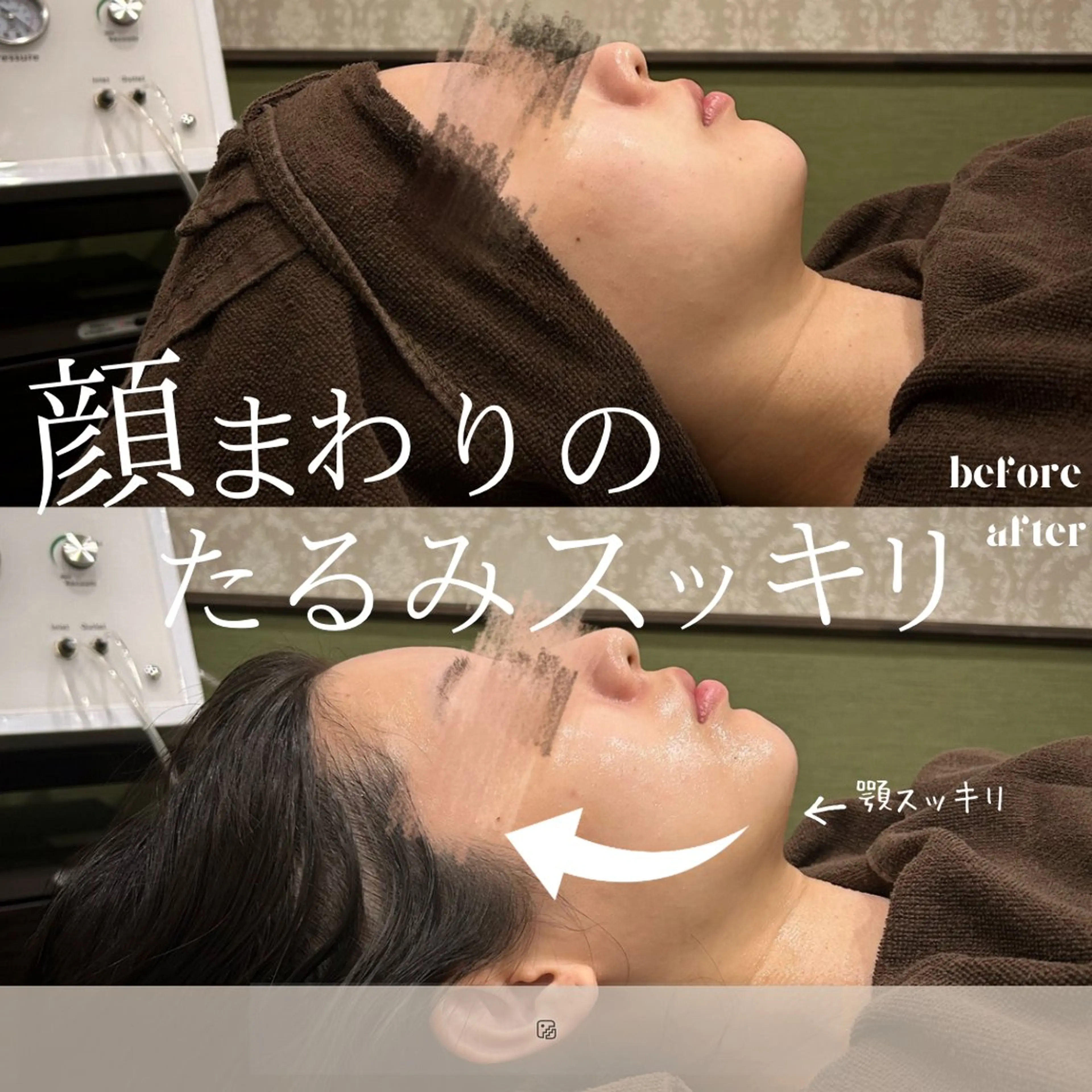 エステ 💎美容革命ラボ💎 大名店のエステ・リラクイメージ