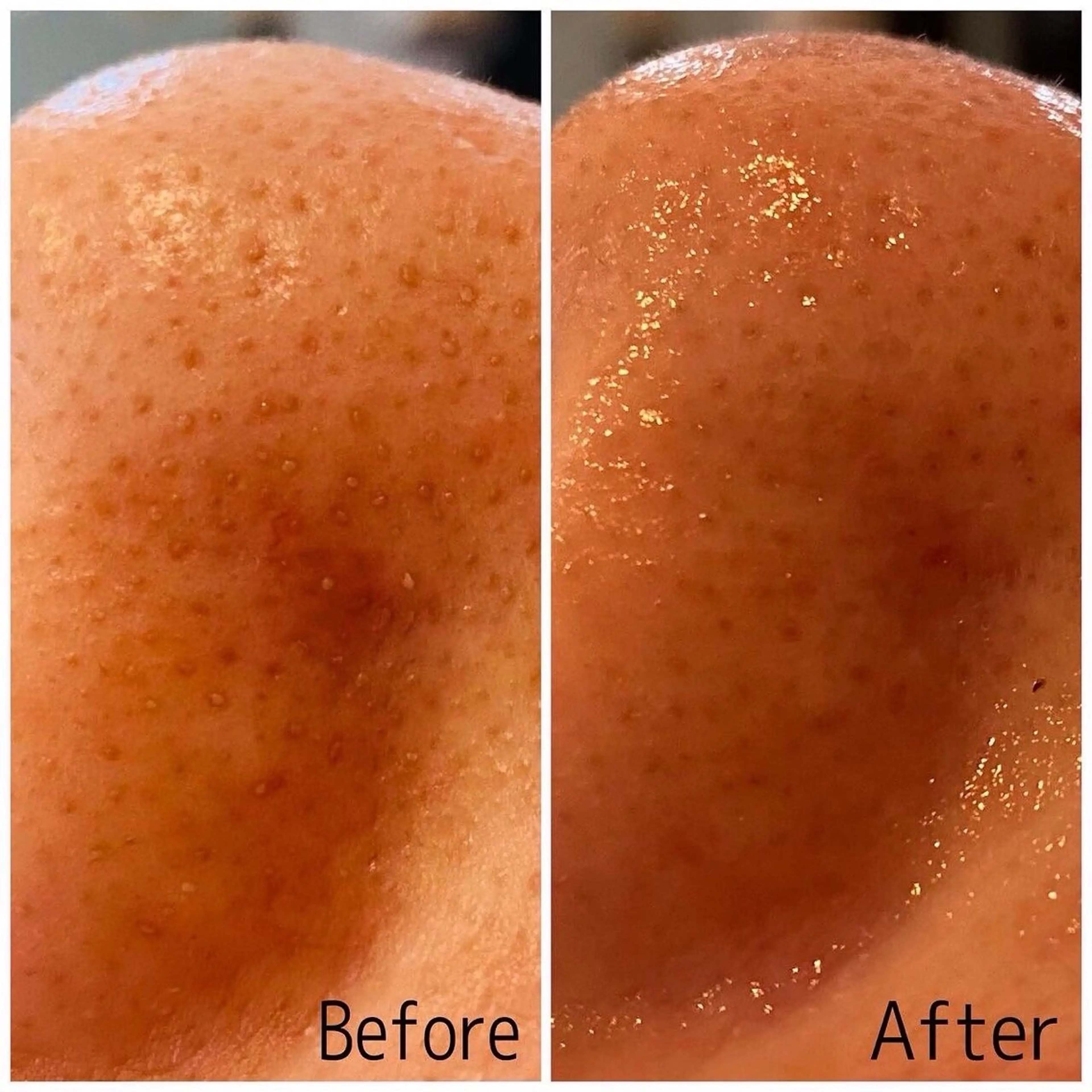 アフロディーテ エステ練習モデル募集のエステ・リラクイメージ