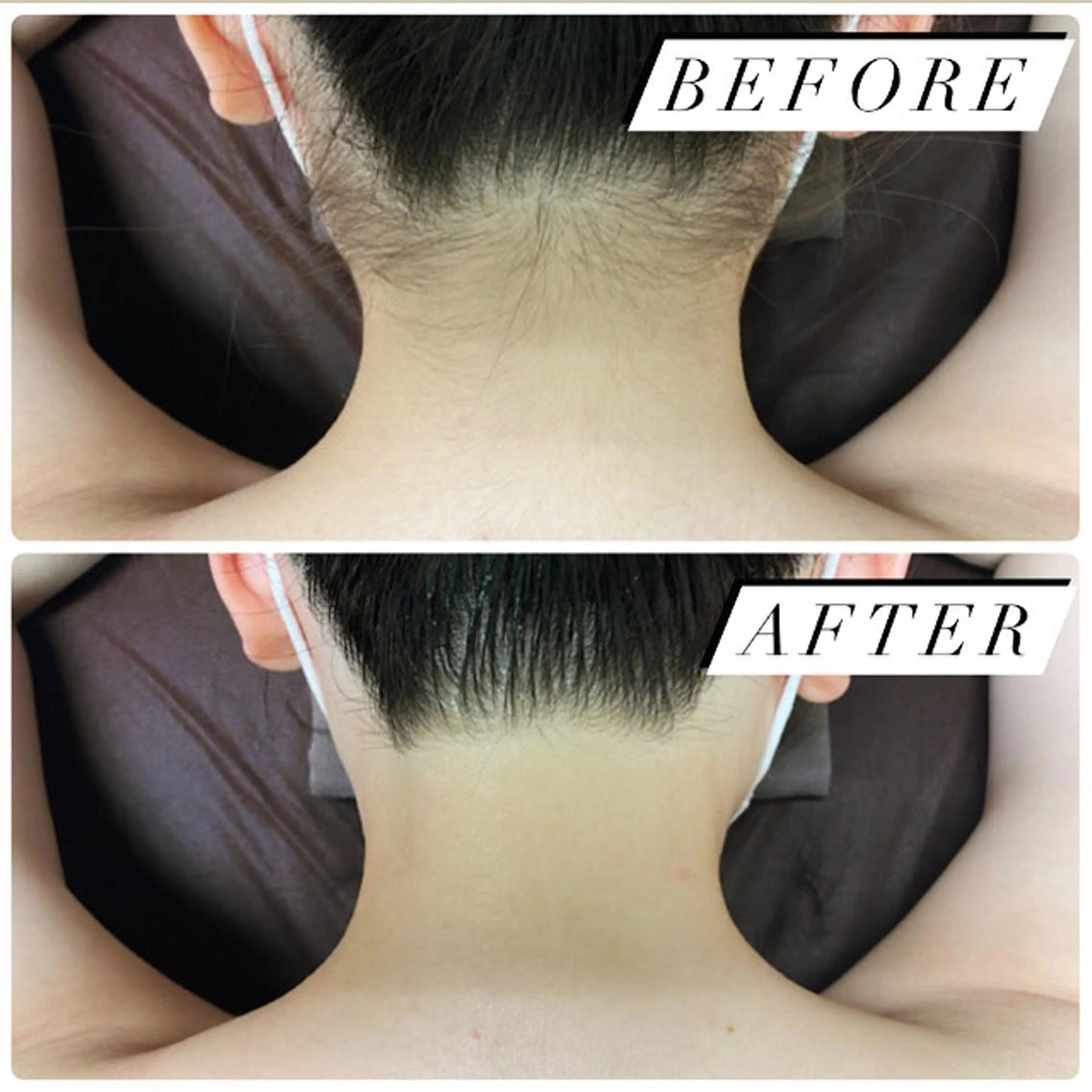 【ミニモ 限定】脇orVライン100円🌼の写真