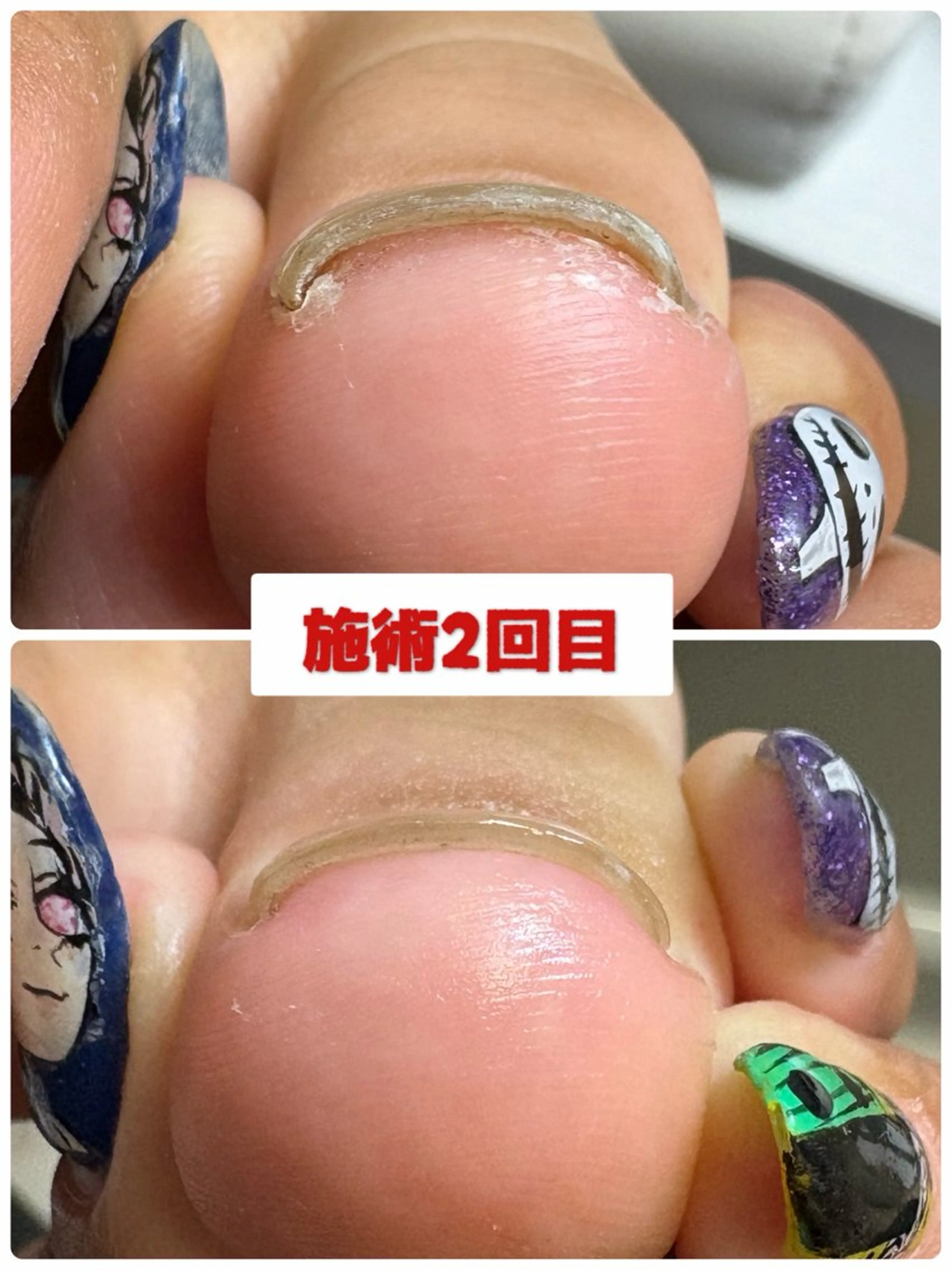 ネイル フットネイル -TOIRO- Eriのネイルデザイン