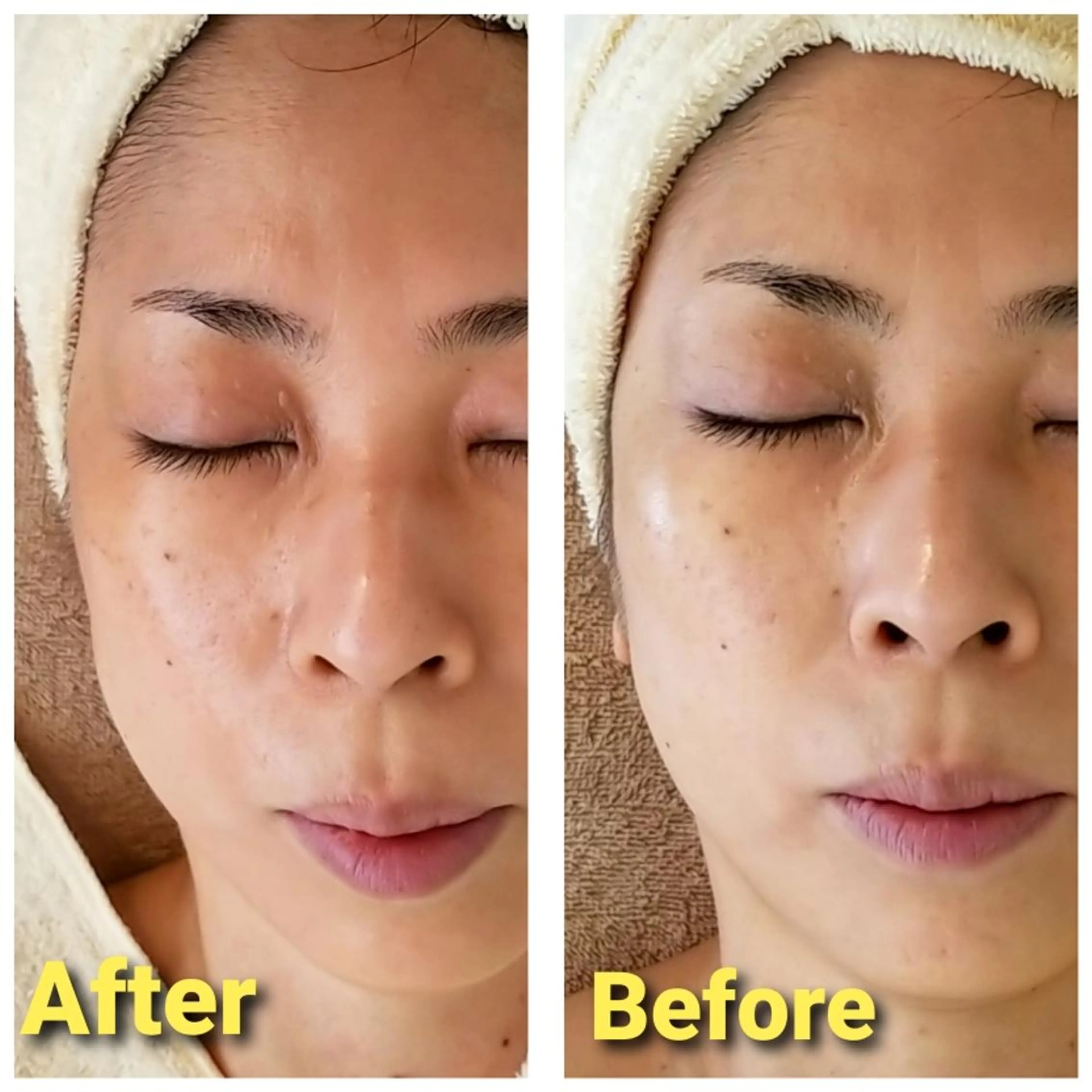 エステ 自然派フェイシャル やながわのエステ・リラクイメージ