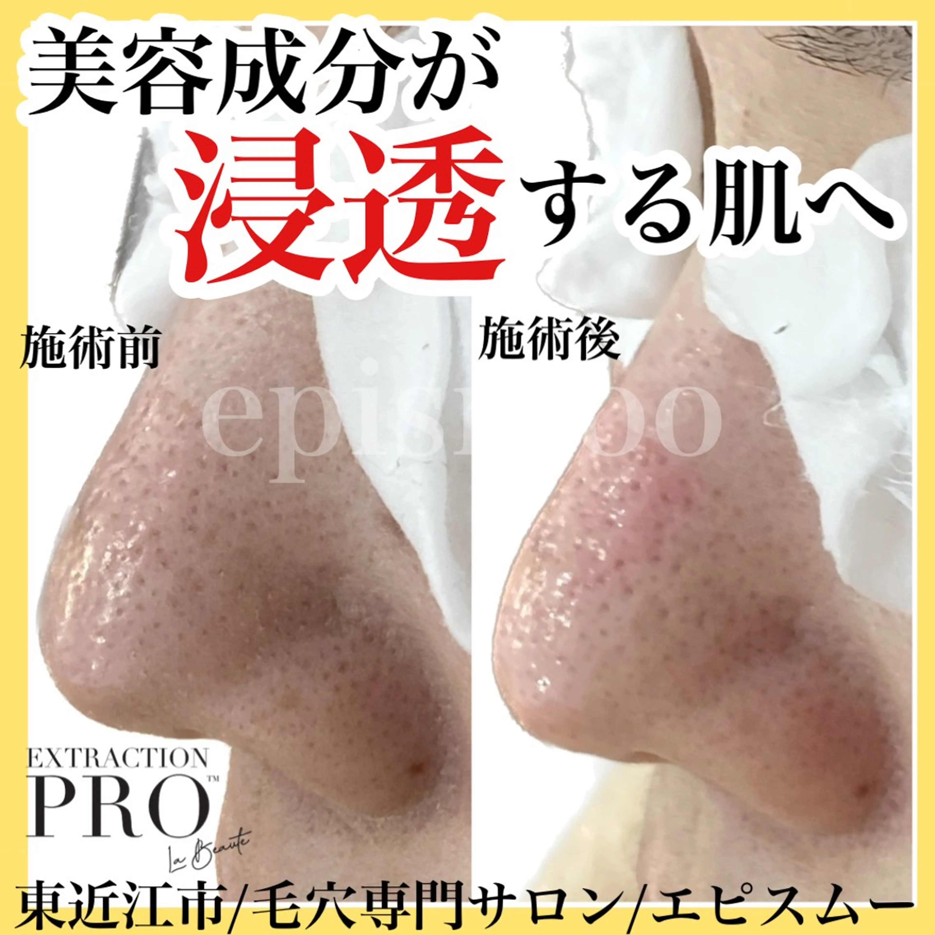 epismoo 脱毛/HBL/毛穴の眉毛・アイブロウイメージ