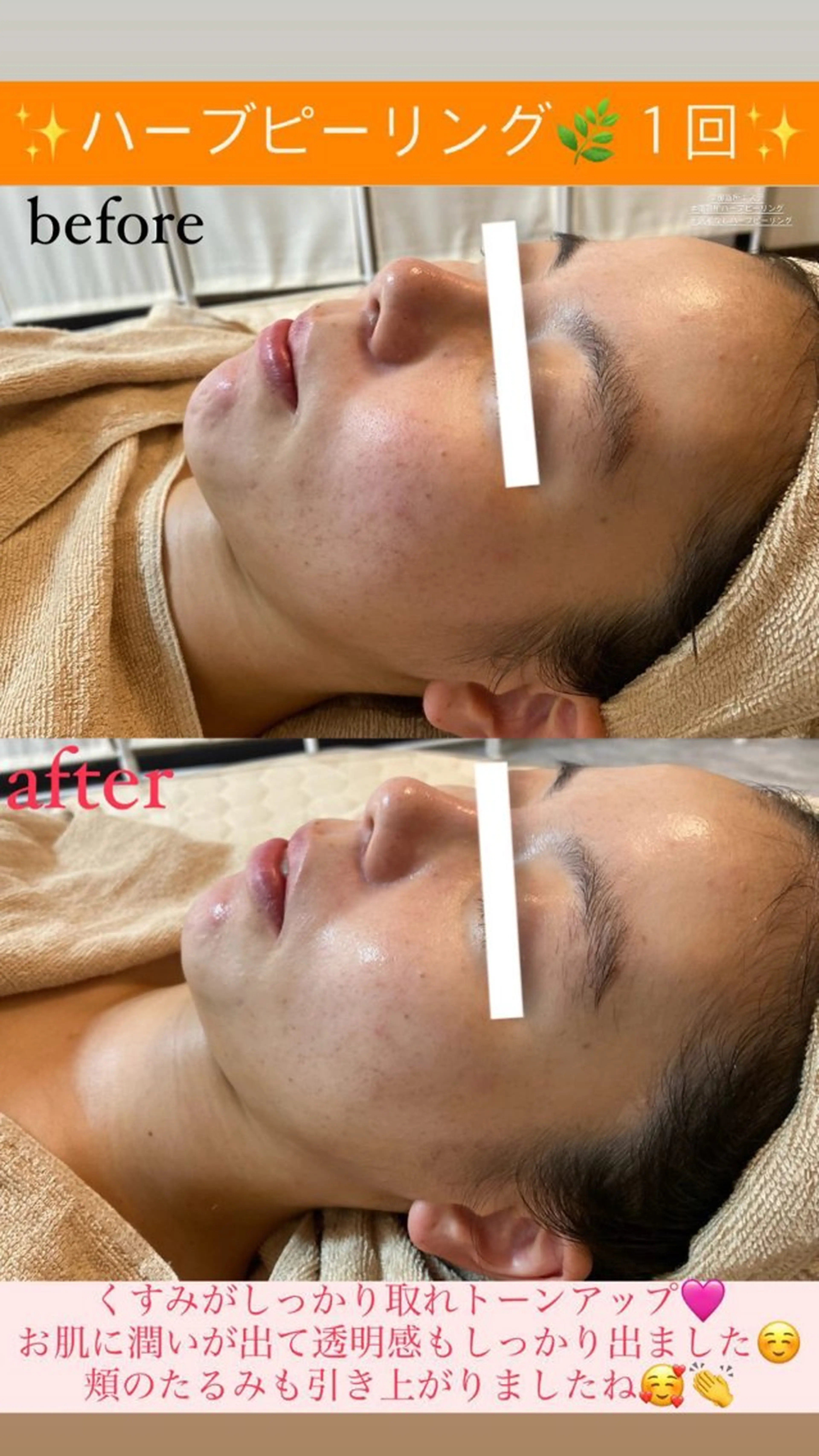 エステ Salon de Lino 御器所のエステ・リラクイメージ