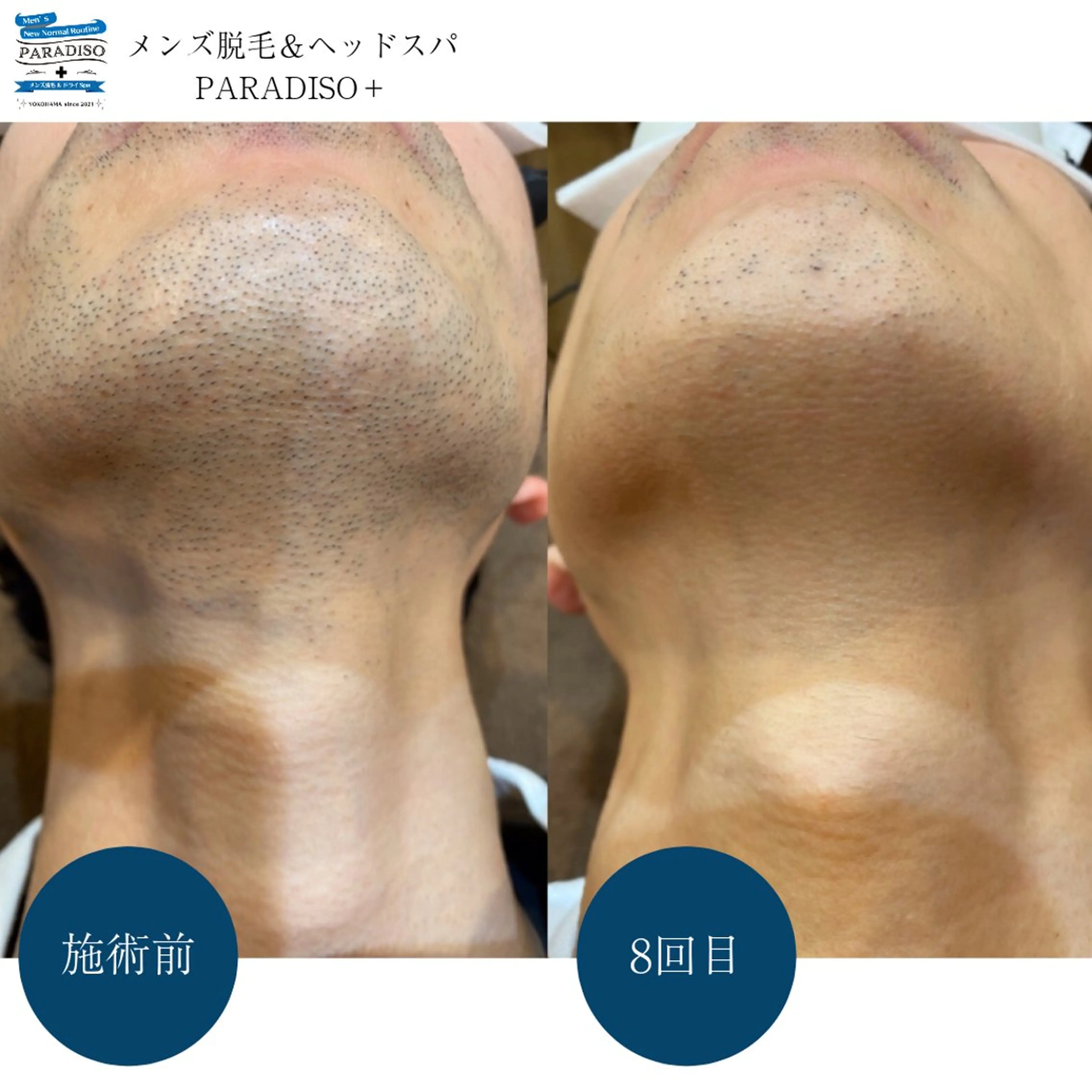 メンズ 後藤 まりやの眉毛・アイブロウイメージ